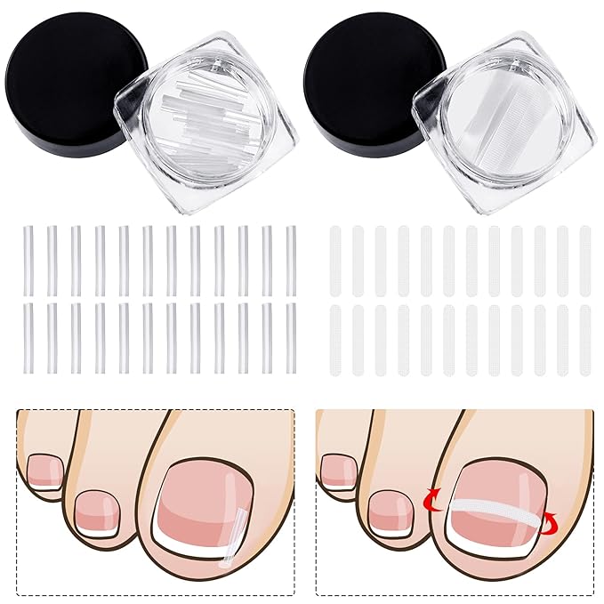 60 Pieces Ingrown Toenail Corrector Strips Ingrown Toenail Correction Brace Toenail