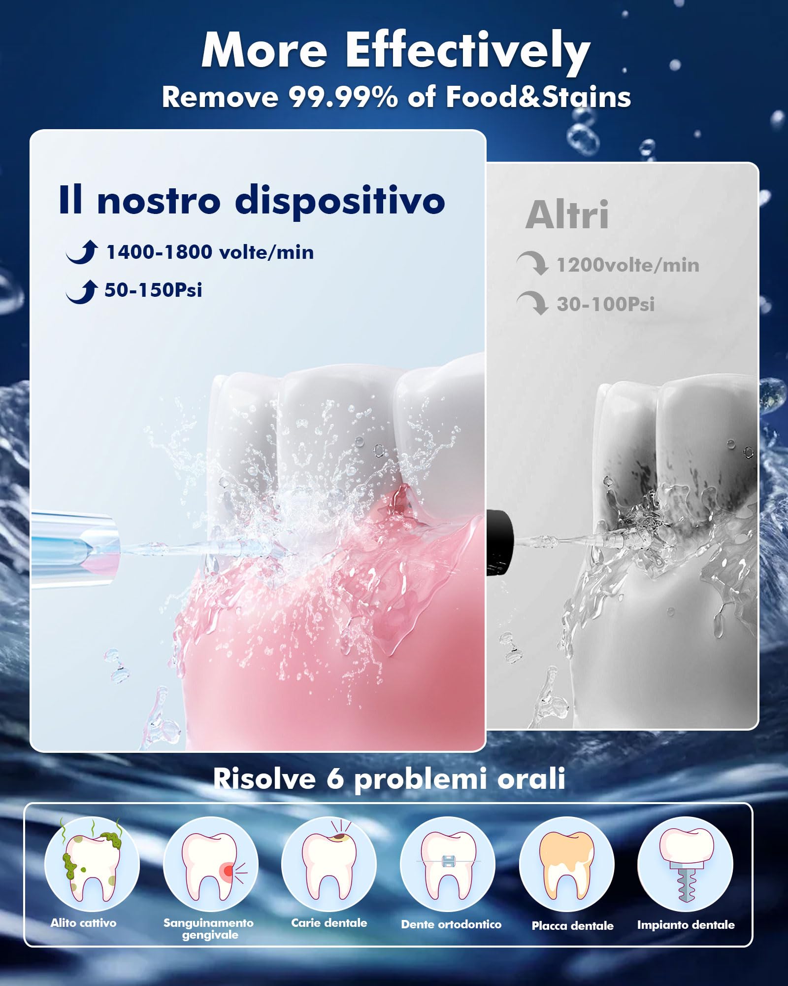 Idropulsore Dentale con 5 Modalità e 6 Beccucci - Design Portatile e Ricaricabile, Serbatoio da 300ml, Pulizia Profonda per Denti e Gengive, Impermeabile IPX7（nero）