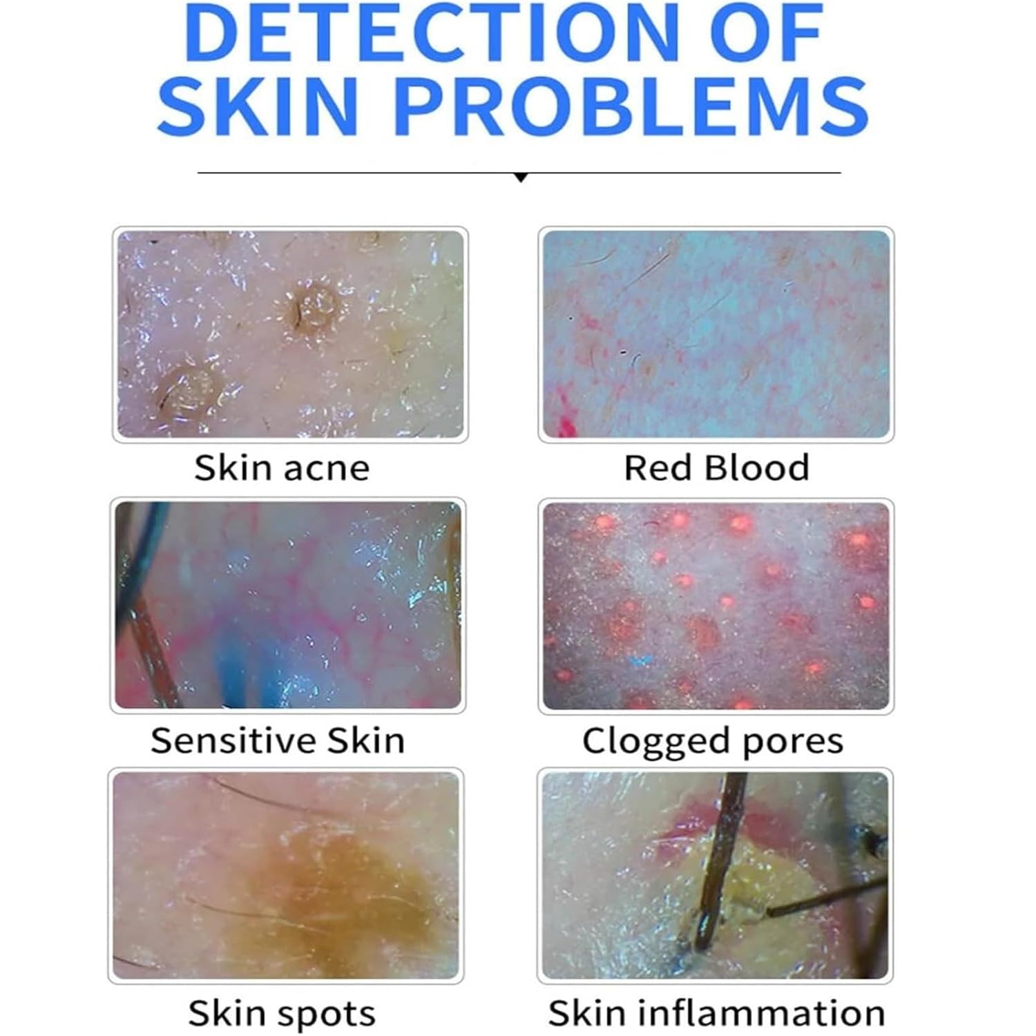 Digital Skin Health Detection Multi-Function Tester, Wireless Skin Analyzer Machine, Skin Hair Analyzer,3 Gears, 1 Megapixel for Head Spa Home Salon Use,Scalp Analysis Machine