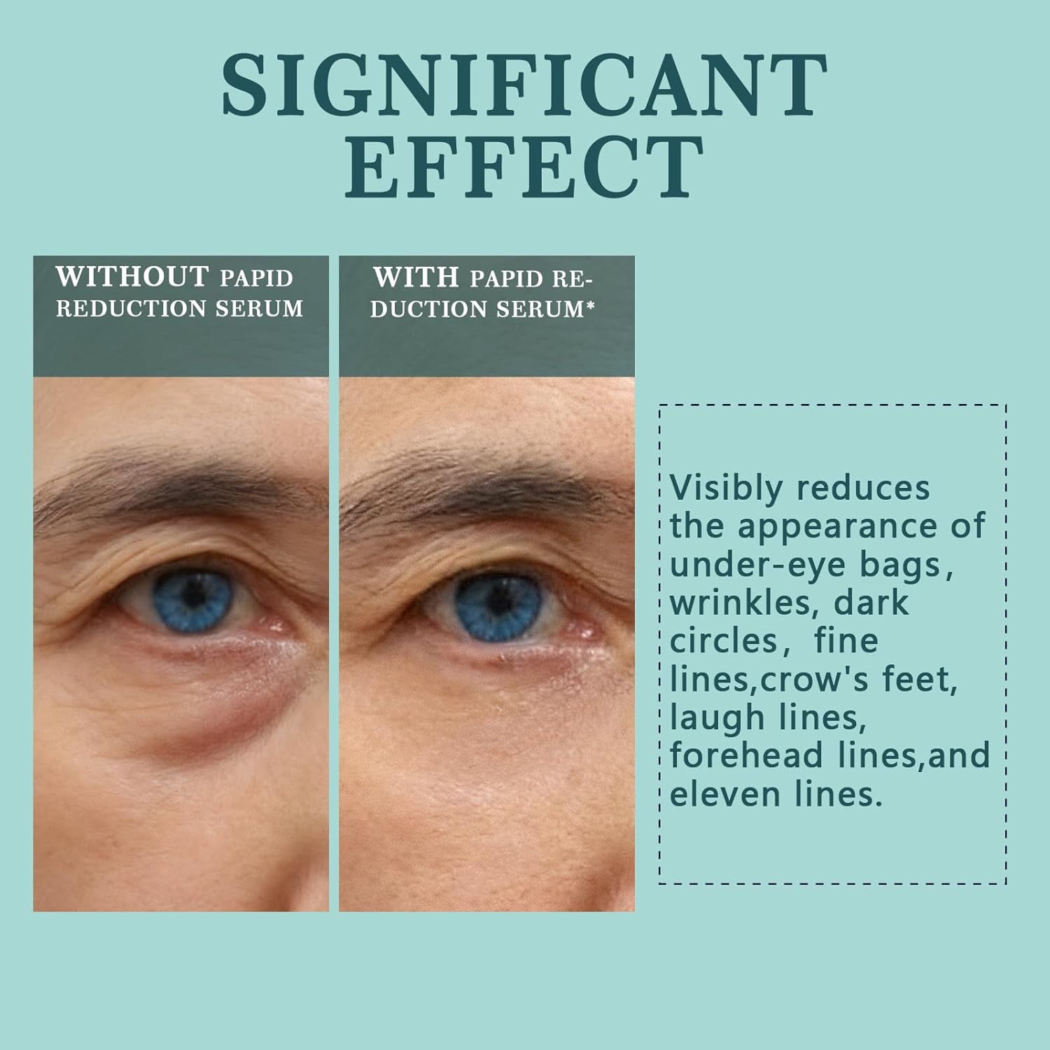 Instant Under Eye Lift Serum - Instant Eye Tightener Cream, Tightener Cream for Under Eye Bags and Wrinkles, Fine Lines, Dark circles, Anti-Aging Wrinkle Remover, 0.5FL.OZ - Image 2