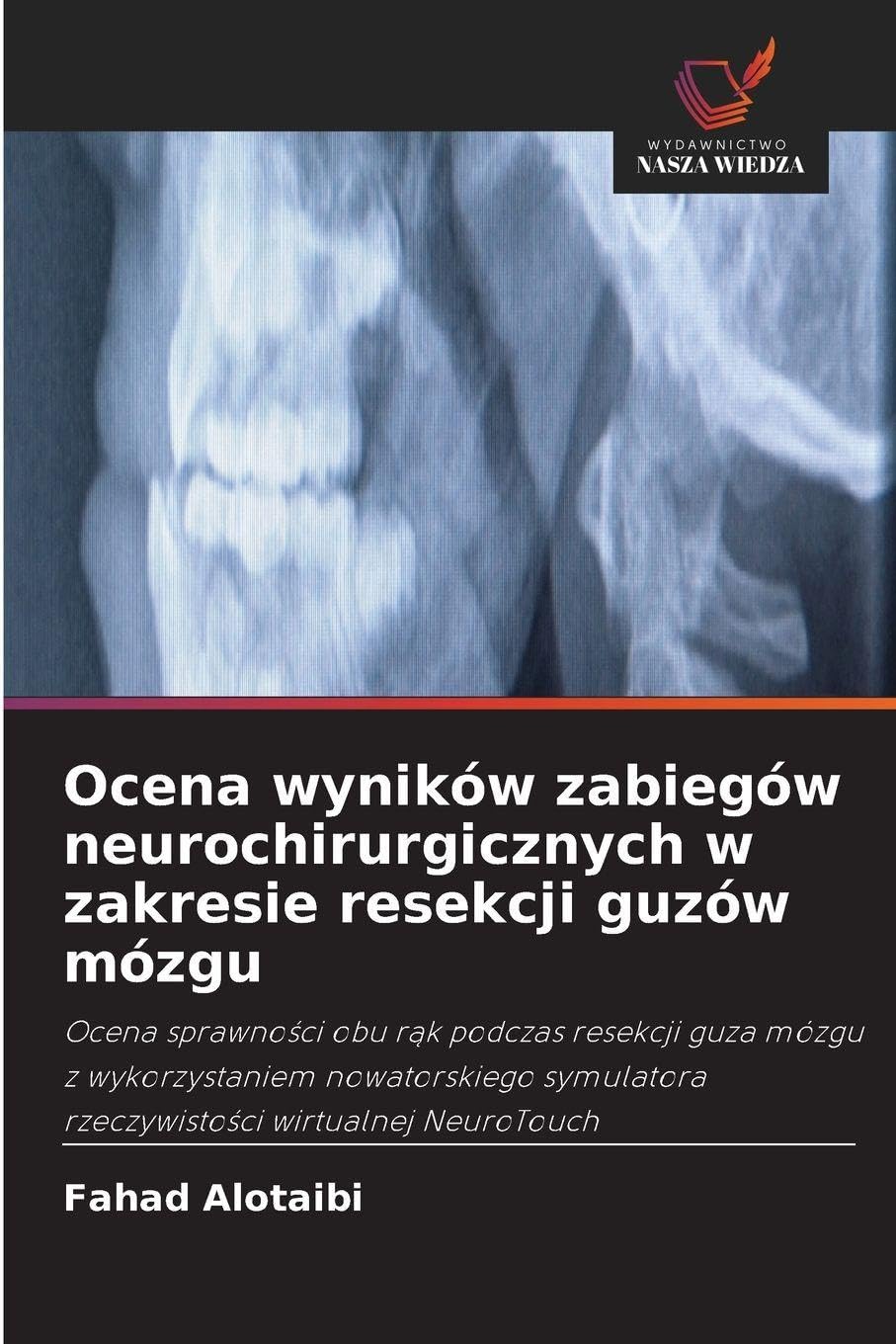 Ocena wyników zabiegów neurochirurgicznych w zakresie resekcji guzów mózgu