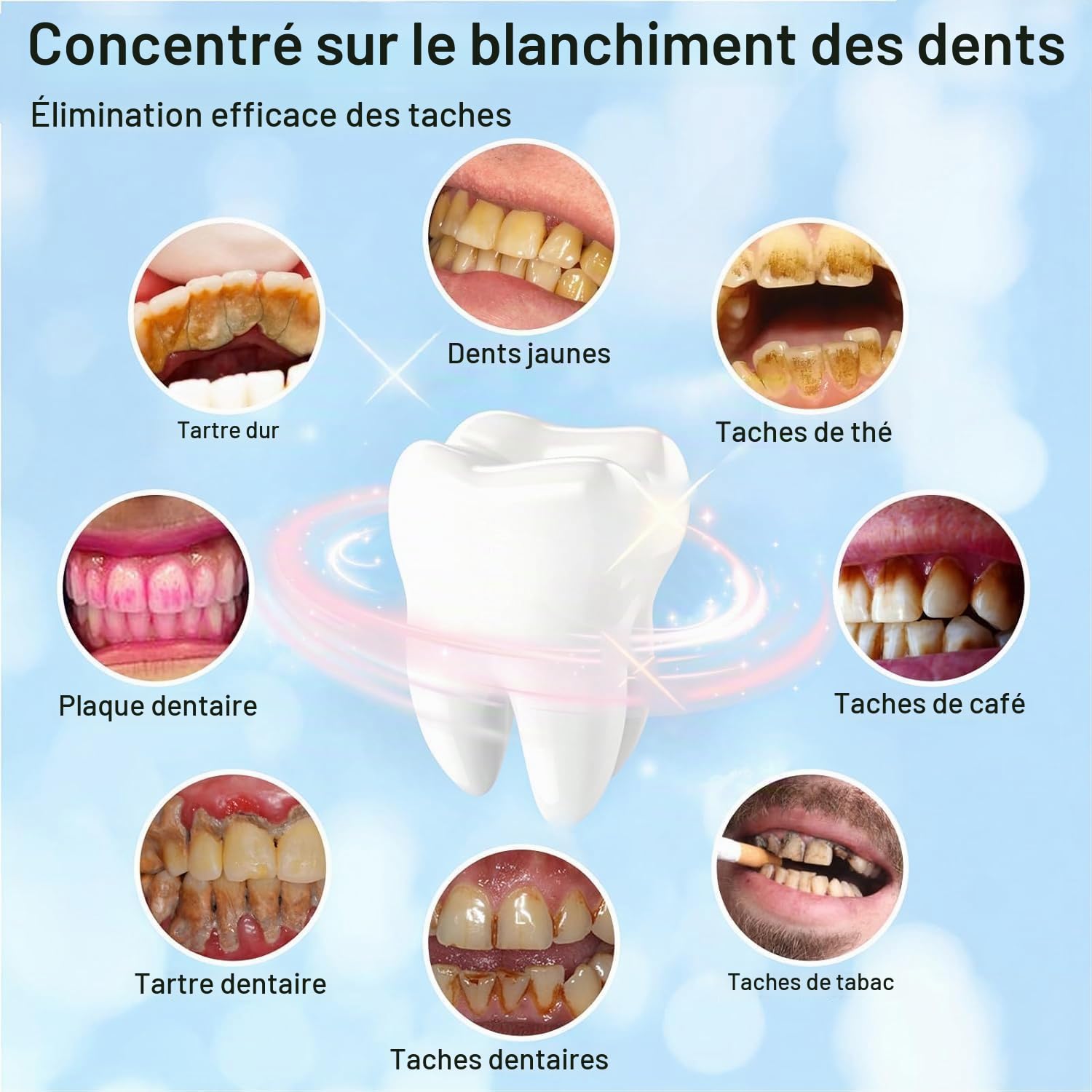 Polisseur Dentaire & Kit Blanchiment Dentaire pour le Polissage des Dents | Blanchiment Dentaire Professionnel avec 5 Mode Polissage et 3 Types de Pate a Polir, Blanchiment des Dents