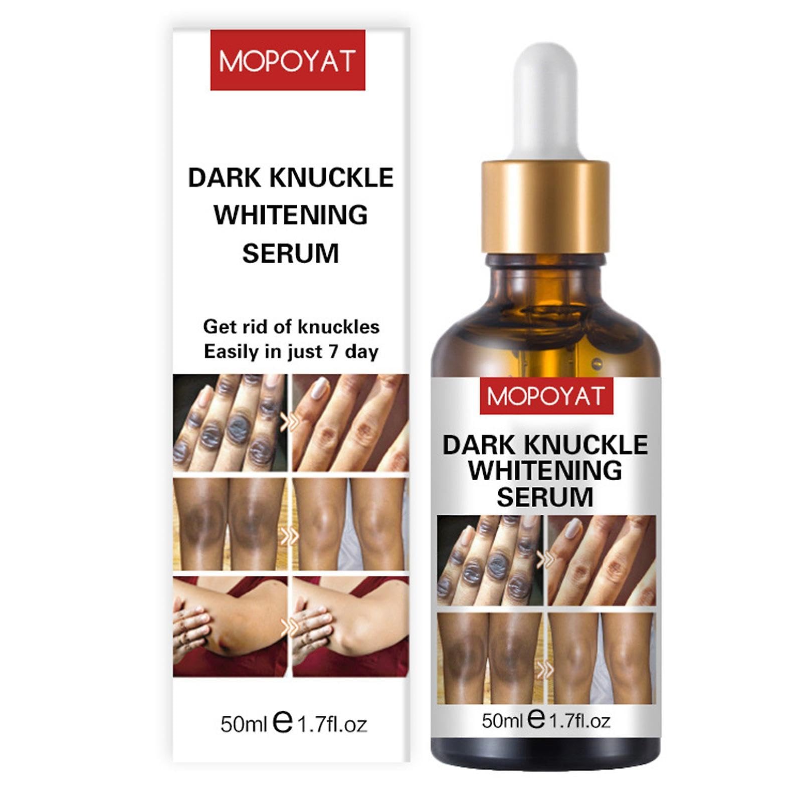 SWEI - Dark Knuckle Whitening Serum 50ml | Finger Joints Brightening Essence | Skin Melanin Removal | Whitening & Smoothing Wrinkles | Lightens Melanin on Joints Knees Elbows & Ankles Hypoallergenic
