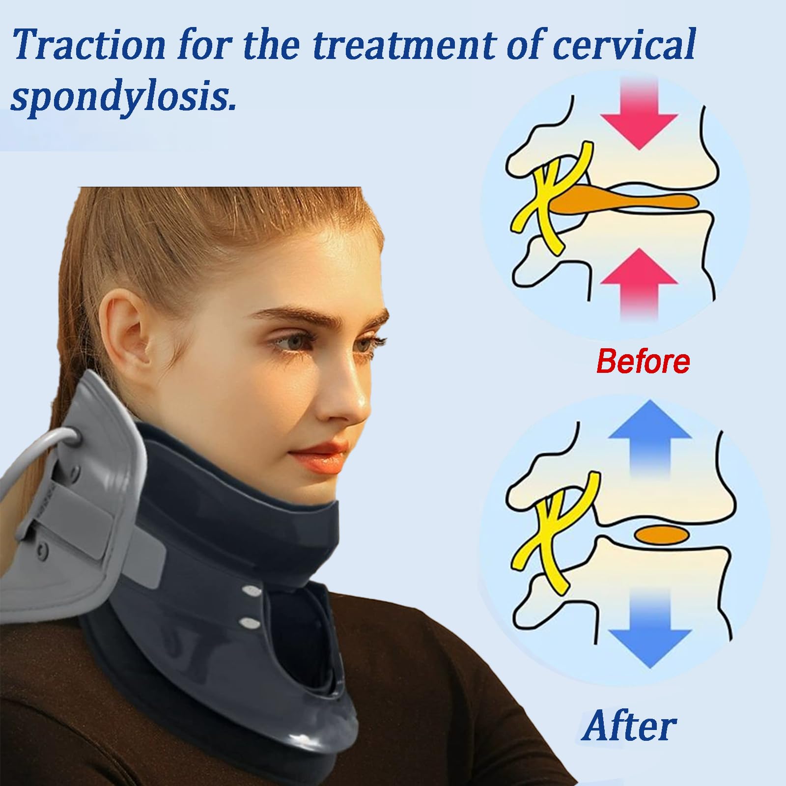 Dispositivo De Tracción Cervical,Inflado Manual,Inflado Manual,Regulable En Altura,Adecuado Para El Dolor De Cuello,Estiramiento Espinal