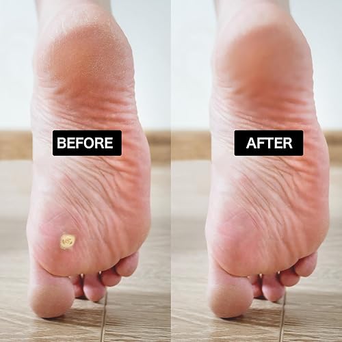 Miniatura 4 de Broca de pedicura, broca de carburo de diamante para uñas, acero inoxidable, profesional, pedicura, callos de pie, lijado, brocas de pulido para