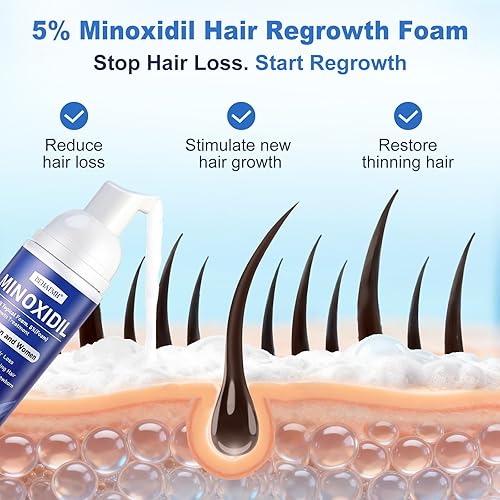 Miniatura 2 de 6 paquetes de 2.7 fl oz de espuma de minoxidil al 5% para hombres y mujeres  6 x 2.71 onzas de suministro para 8 meses, con biotina y aceite de