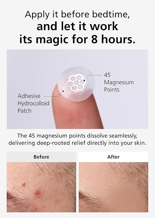 EasyDerm Quick Calming Magnesium Patches and Acne Treatment Tool 2-in-1 Pimple Popper