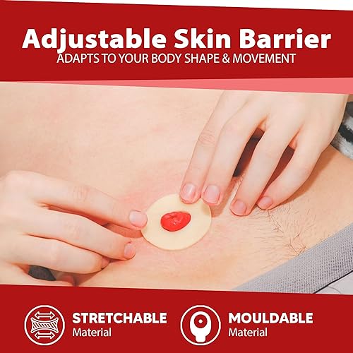 Miniatura 6 de Ostomía Suministros Médicos Barrera Anillo Barrera Anillos 2" 1.890 in Caja de 10 por MED Supplies Is Us