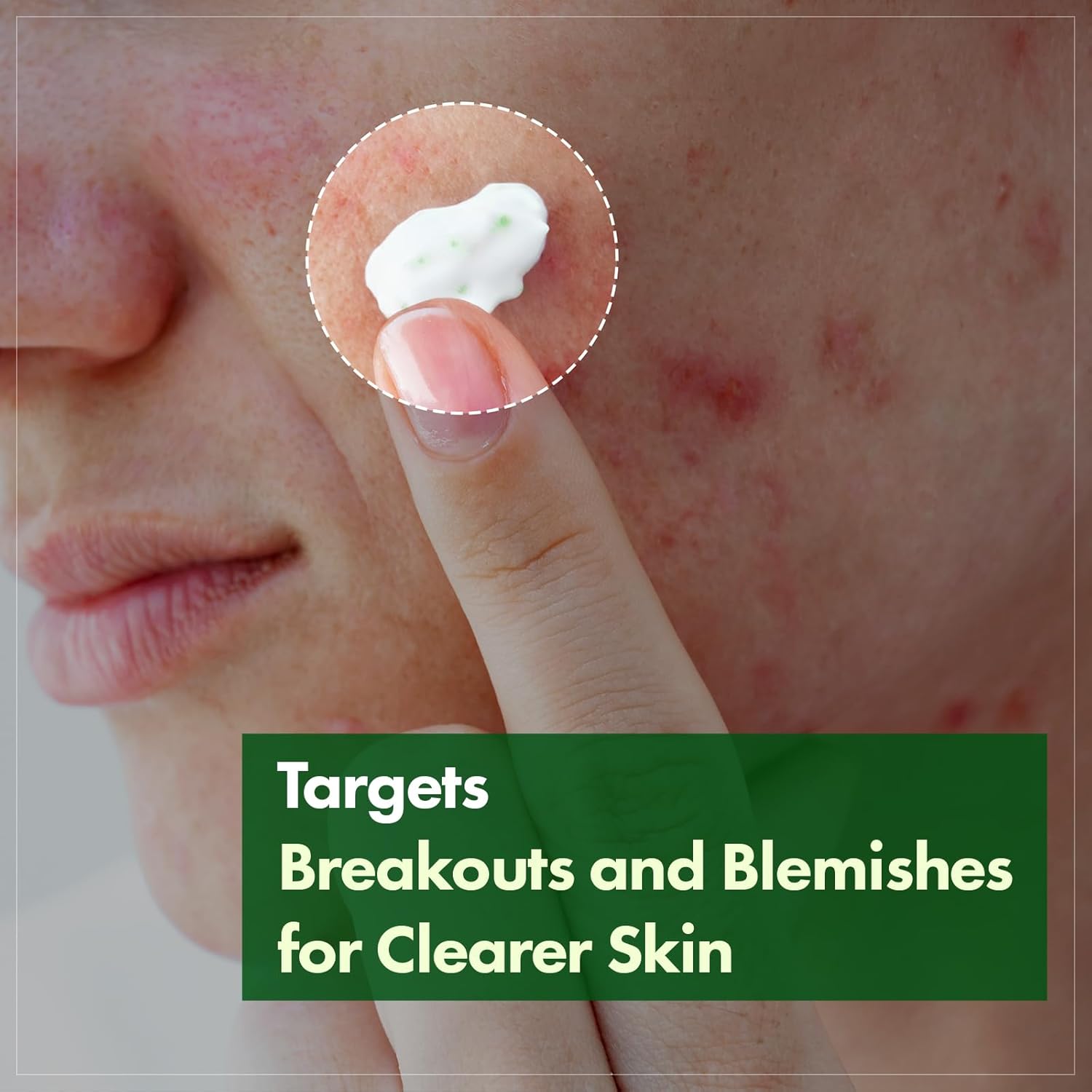 TOSOWOONG Madagascar Centella Cream, 706,580ppm Madagascar Centella Asiatica, Moisturizer, Rapid Soothing, Deep Hydration with Cica Complex, Skin Barrier Repair, Irritation Relief, 50ml / 1.69 fl. oz. - Image 2