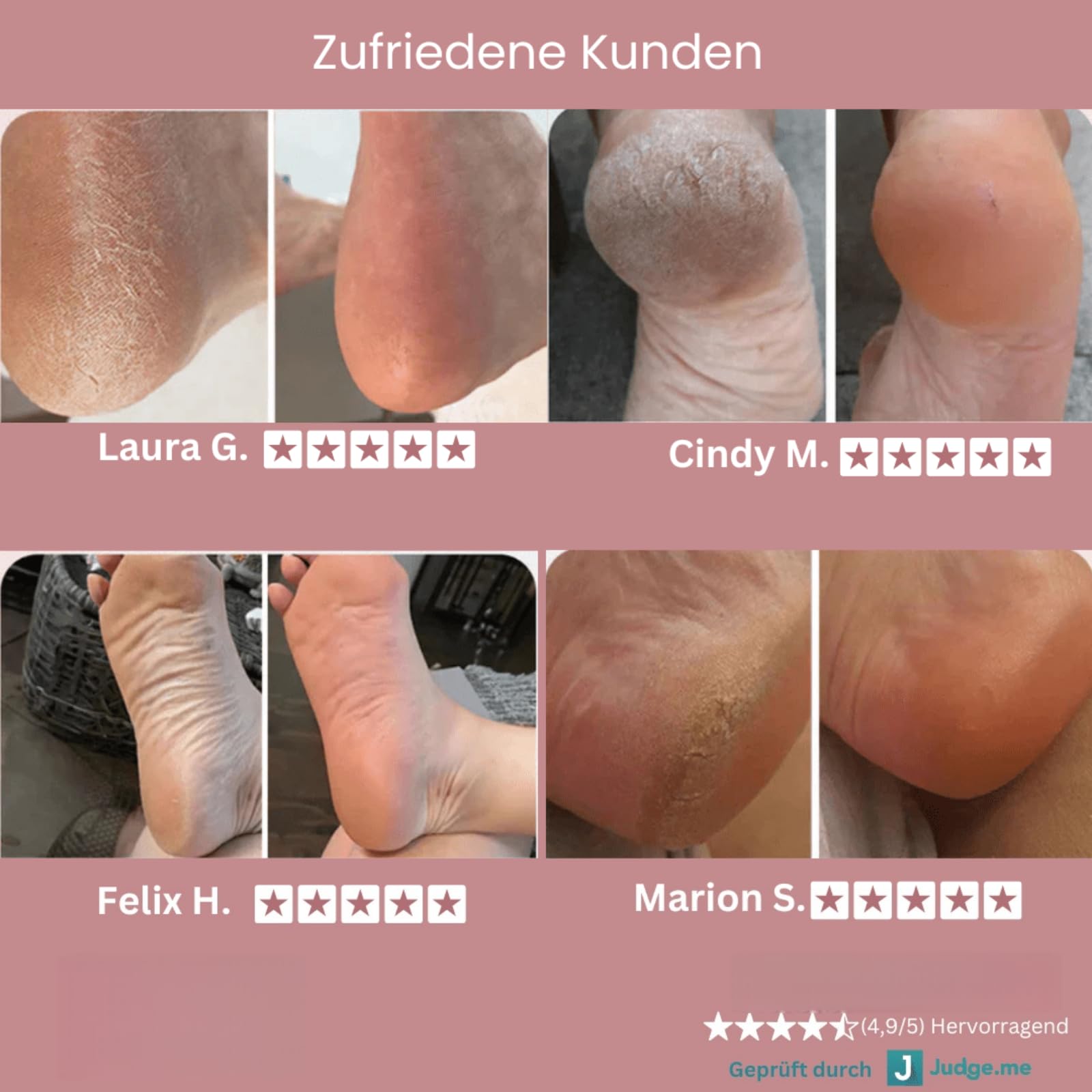 Dermaglide Hornhaut Entferner,Foot Glow Hornhaut Entferner,Professioneller Elektrischer Hornhautentferner mit 60 austauschbaren Schleifpapierscheiben für Abgestorbene Haut & Schwielen