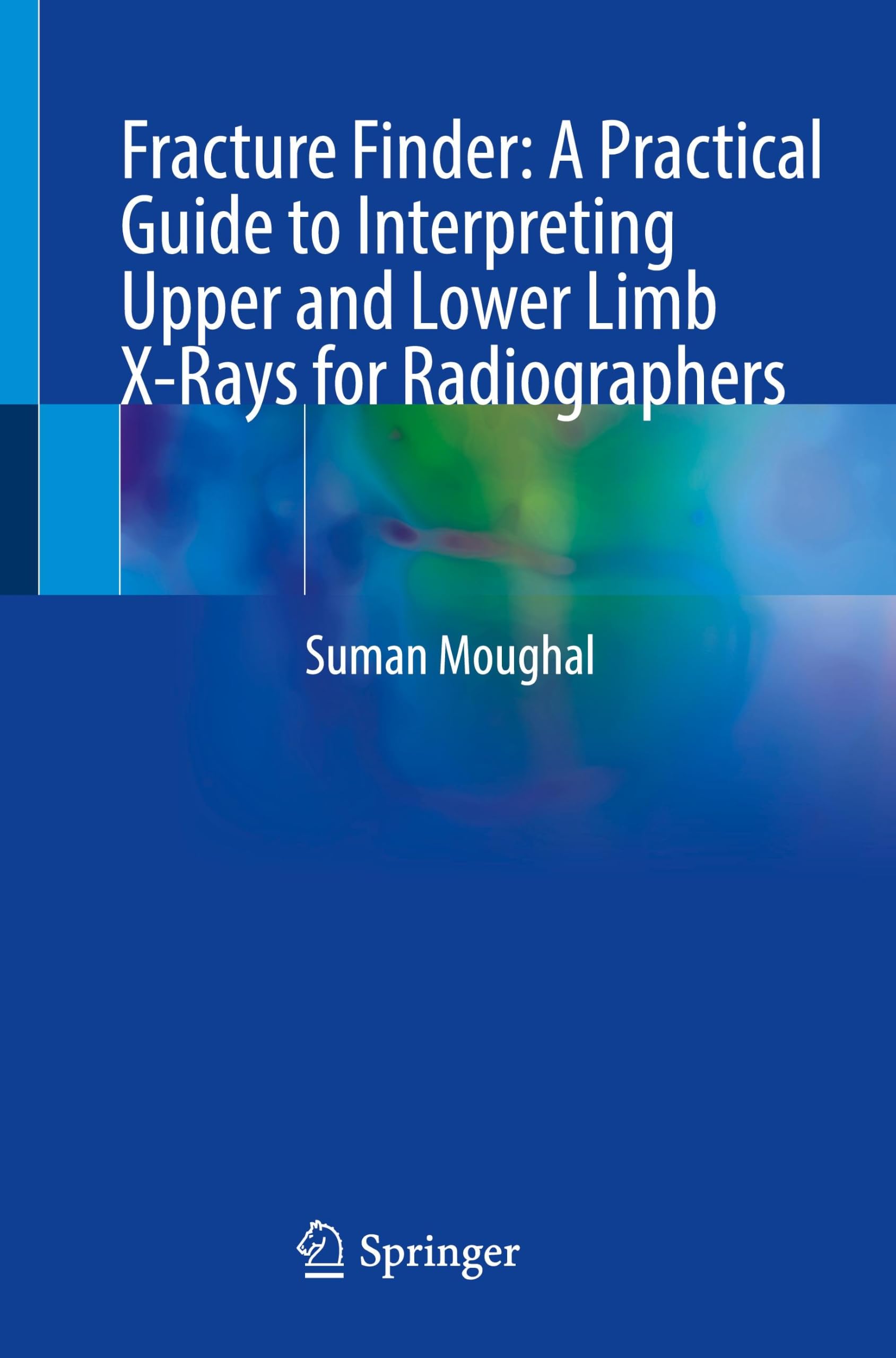 Fracture Finder: A Practical Guide to Interpreting Upper and Lower Limb X-Rays for Radiographers