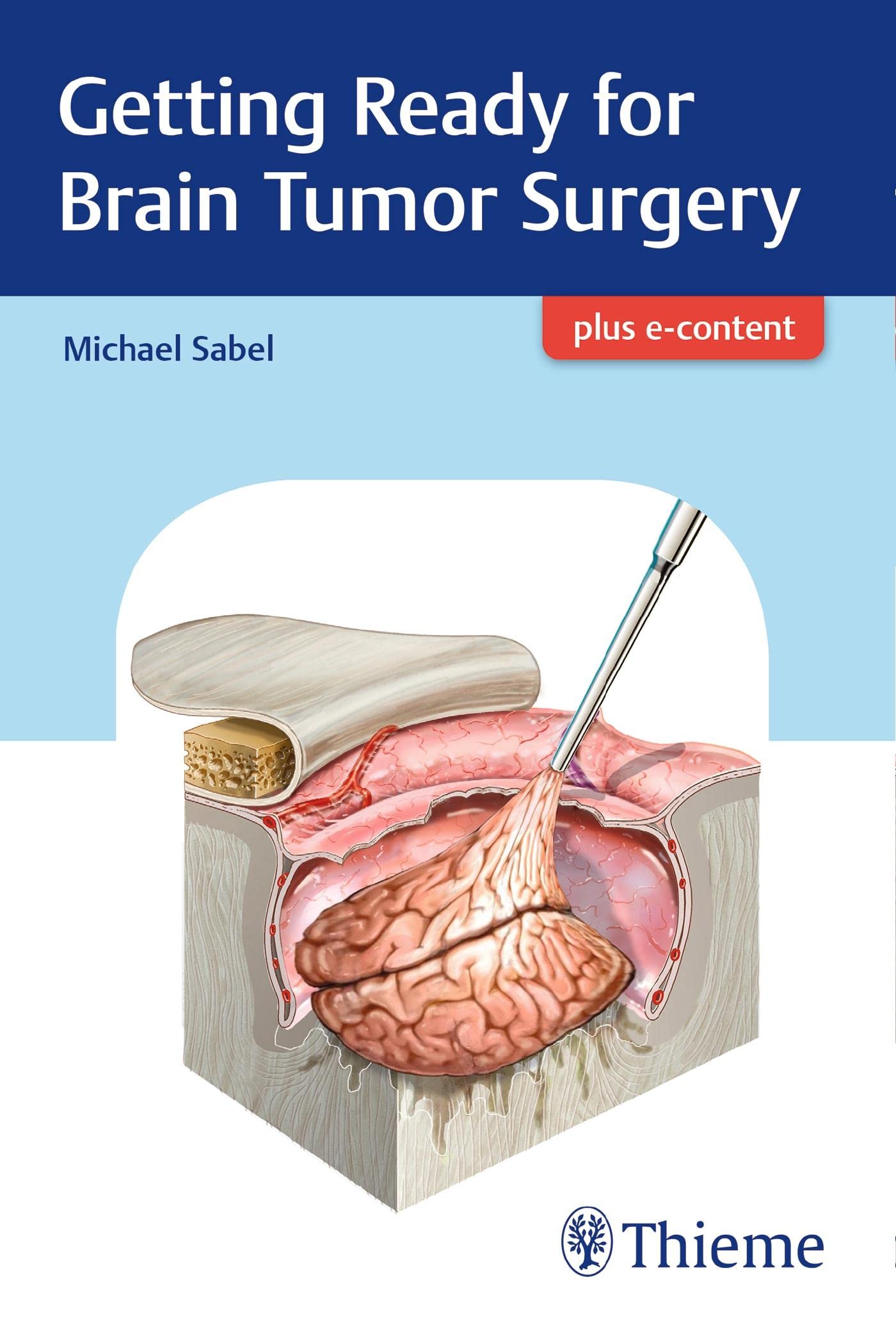 Buy Getting Ready for Brain Tumor Surgery Book Online at Low Prices in  India | Getting Ready for Brain Tumor Surgery Reviews & Ratings - Amazon.in