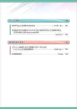 新OS NEXUS No.14 上肢の関節温存手術 上肢の関節温存手術［Web動画付］ (新OS NEXUS No.14) | 今井