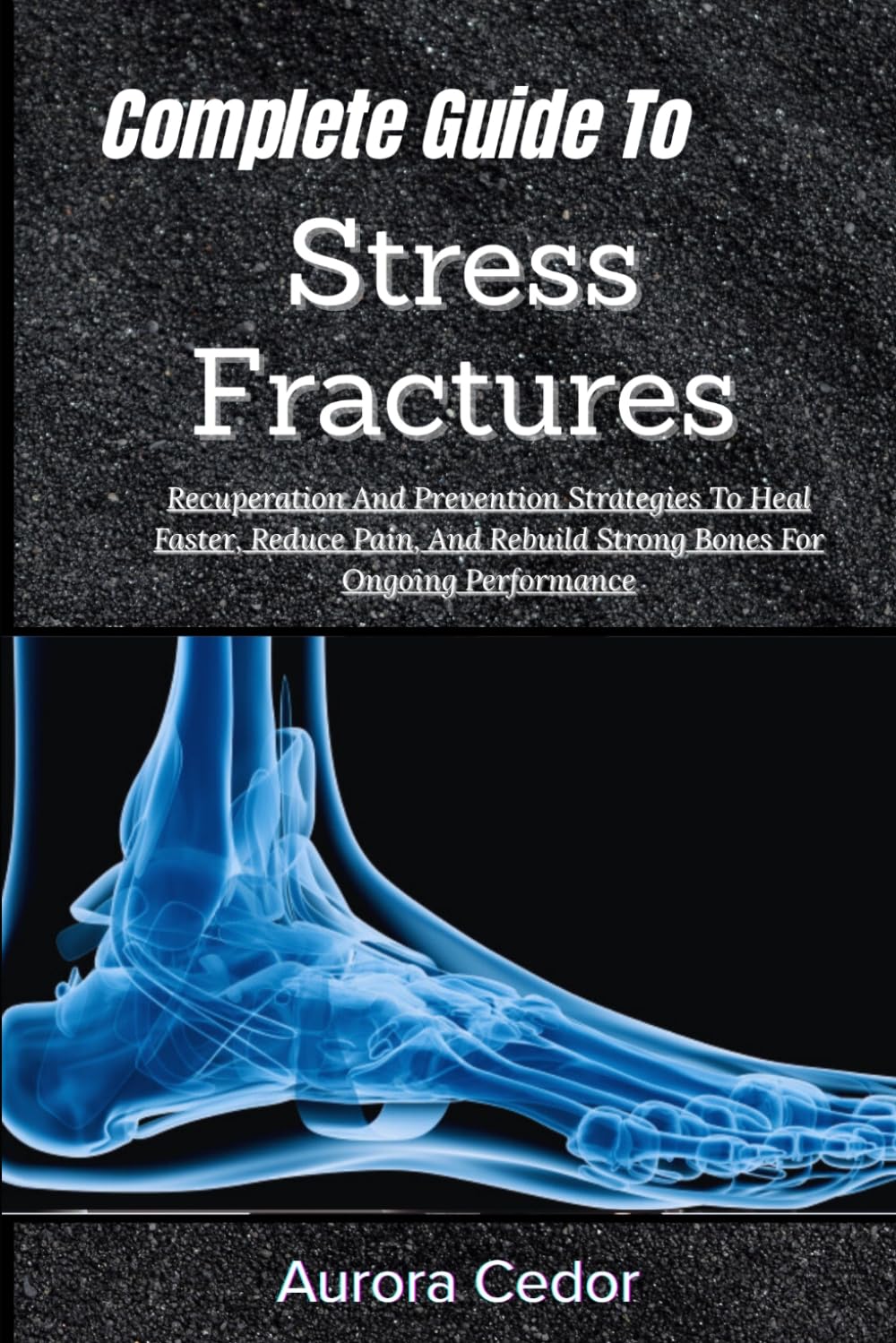 Complete Guide To Stress Fractures: Recuperation And Prevention Strategies To Heal Faster, Reduce Pain, And Rebuild Strong Bones For Ongoing Performance