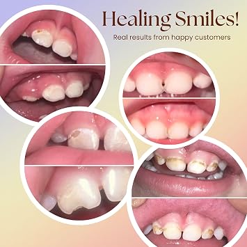 Bliss Energetics Remineralizing Tooth Puddy | Fluoride-Free with Hydroxyapatite | Remineralization | All Natural Ingredients & Preservative Free | Mineral-Rich Spot Treatment 2oz