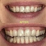 Review Image by Nael Nael