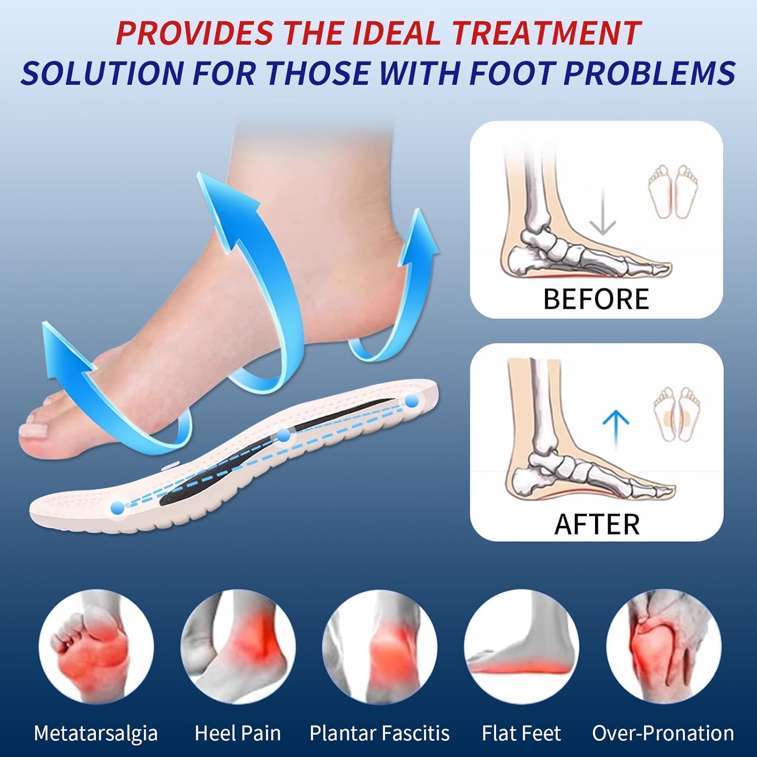 Orthotic Insoles Arch Support Shoe Insoles for Plantar Fasciitis & Heel Pain Relief Medical 3D Running Work Boot Inserts for Flat Feet Women Men Elderly Nurses Standing All Day (Men 4.5 / Women 6.5) - Image 3