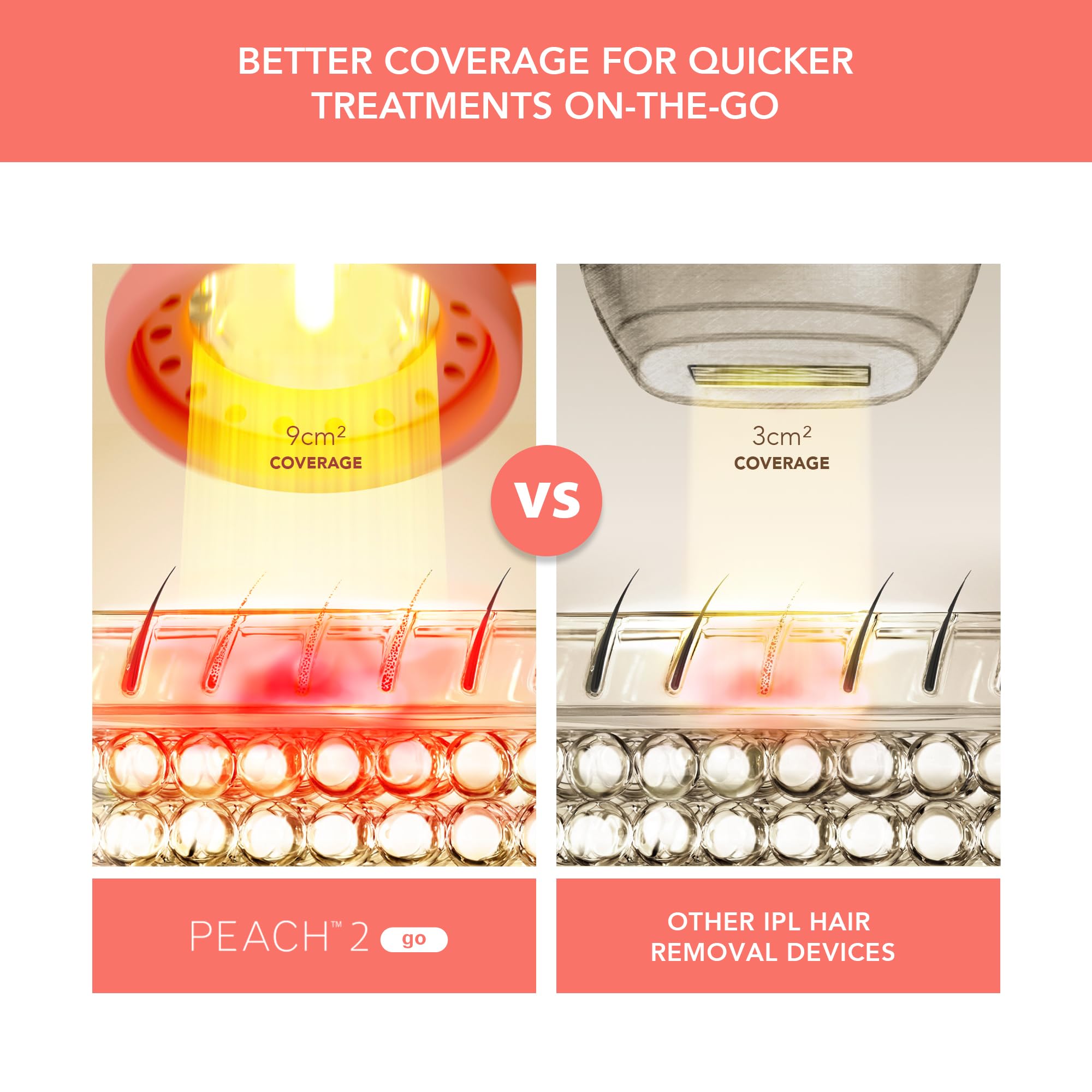 FOREO Peach 2 go IPL Hair Removal Device - Travel-Friendly Permanent Hair Removal - Laser Hair Removal - Body & Face - Painless Hair Removal - Skin Cooling & Silicone Shield - Customizable - Coral