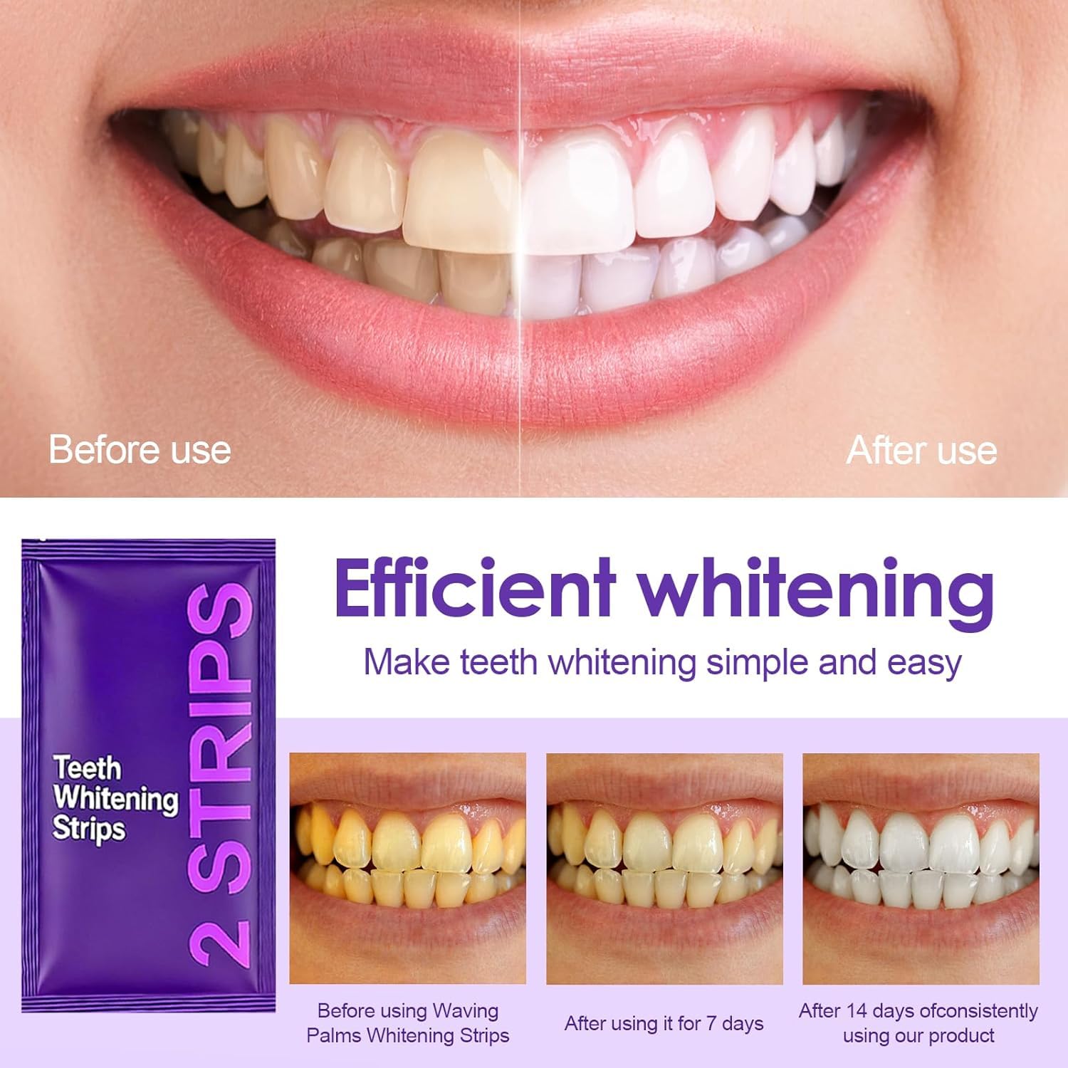 Drdent Tiras Blanqueadoras Dentales Púrpura,blanqueador Dental Profesional, Eliminan Manchas Y Hacen Que La Sonrisa Brille (1 Stück 42pcs)