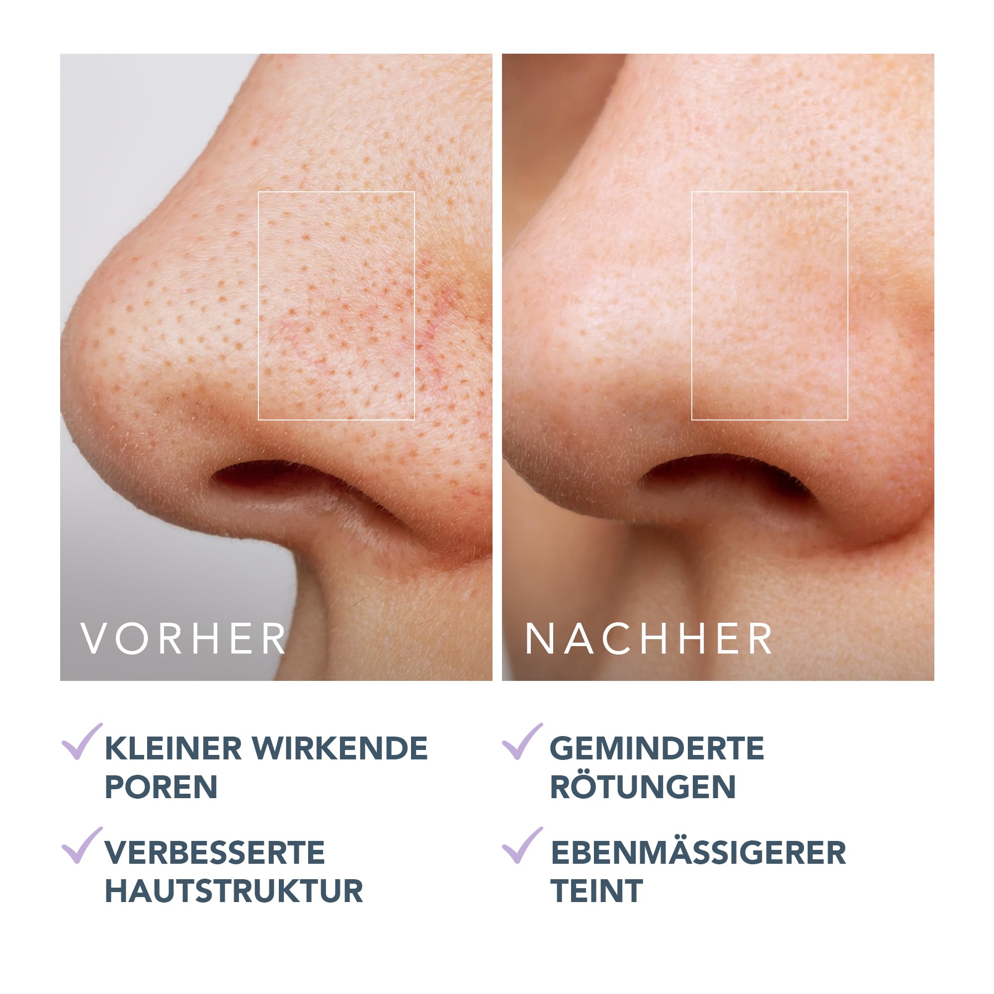 FOREO KIWI Porenverfeinernde Toner-Pads – Hamamelis & Cica, 60 Stk.