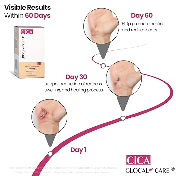 CICA Silicone Scar Cream Helps with Scar Removal - Surgical, Acne & Trauma Scars, Stretch Mark Cream for New & Old Scars Medical Grade Silicone with TECA & Hyaluronic Acid