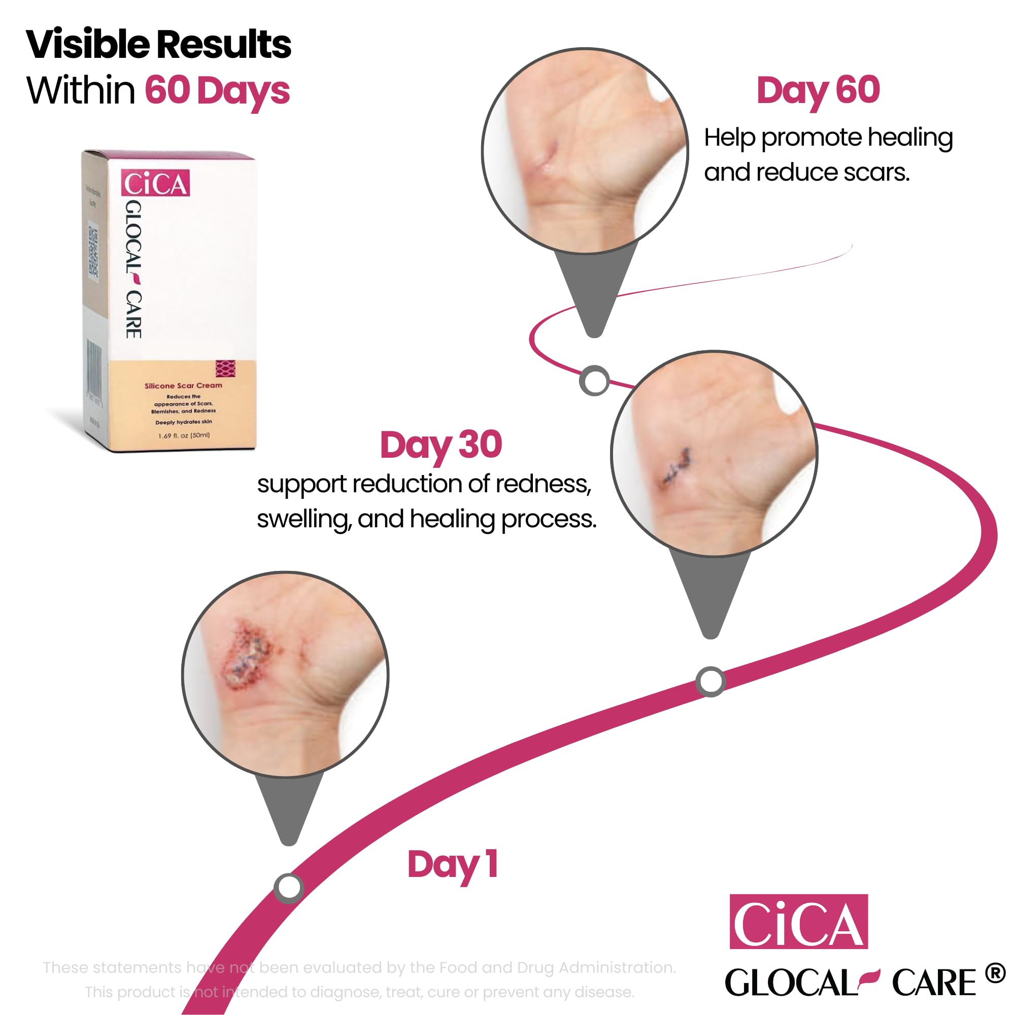 can glutathione remove old scars CICA Silicone Scar Cream – Helps with Scar Removal Anti-aging capsules with Vitamin C