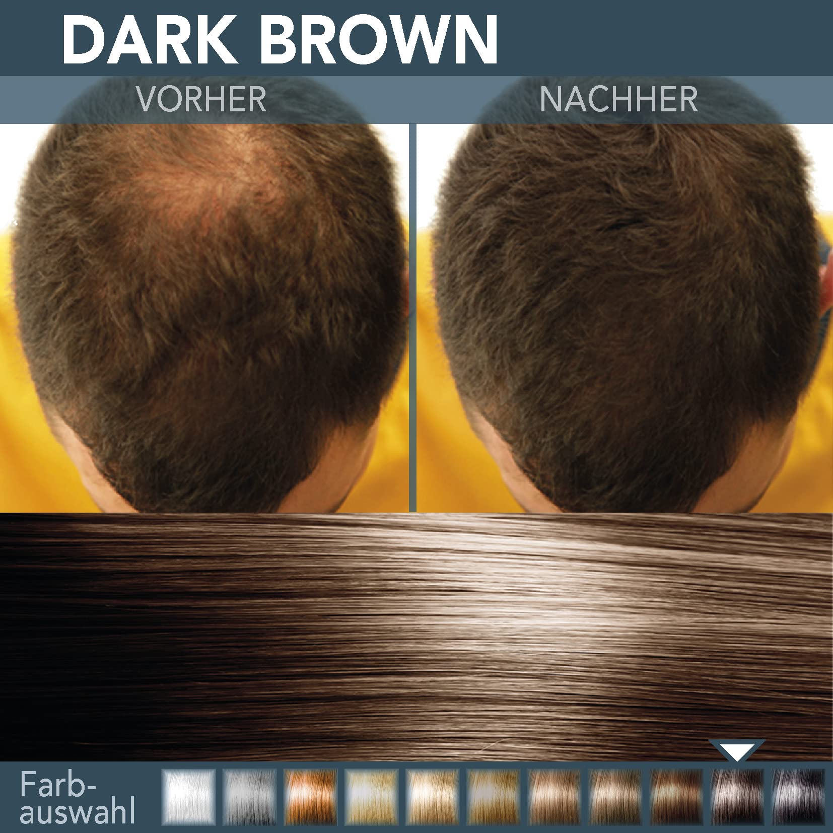 Cover Hair® Premium Streuhaar - 26g I Schütthaar zur Haarverdichtung & Ansatzkaschierung - Natürlicher Look in Sekunden I Hair Fiber für Männer & Frauen I Streuhaar Dunkelbraun