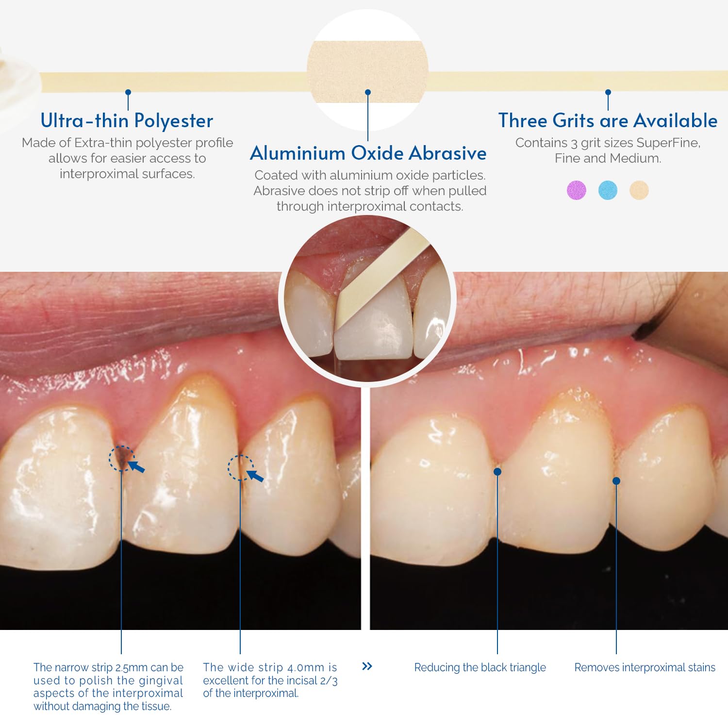 Tiras abrasivas dentales 6m x 4mm ultrafino Resina NatureAqua pulido interdental