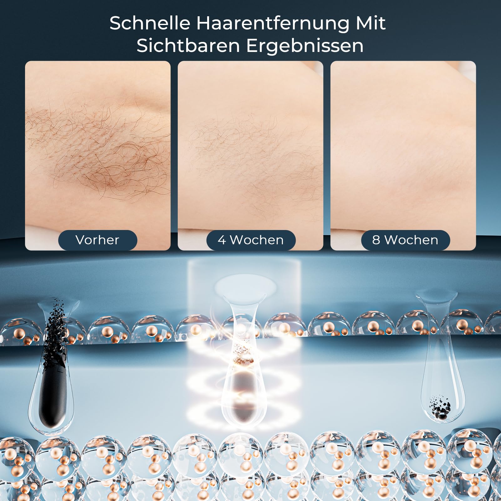 Max 21J Epilatore Luce Pulsata, 9 Livelli di Energia, 600 NM Laser Epilatore a luce pulsata, IPL Luce Pulsata 999,900, Epilatore Laser per Donna,Uomo,Viso,Bikini,Corpo
