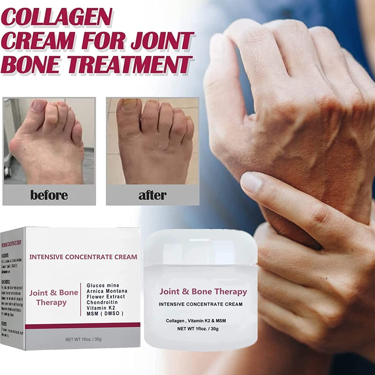 3 pcs Perfectx Joint & Bone Therapy Cream,Joint and Bone Therapy Cream,Pain Relief Cream for Muscle, Joint,Back, Ankle,Hands,Foot