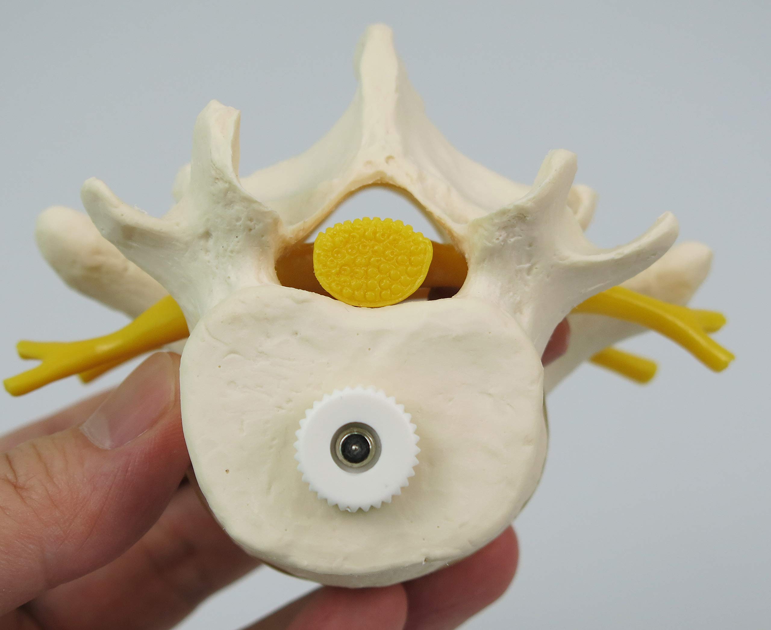 3B Scientific® 2 Vertèbres Lombaires avec Hernie Discale – Modèles Anatomiques Montés de Manière Flexible + Smart Anatomy App (Garantie de 5 Ans)