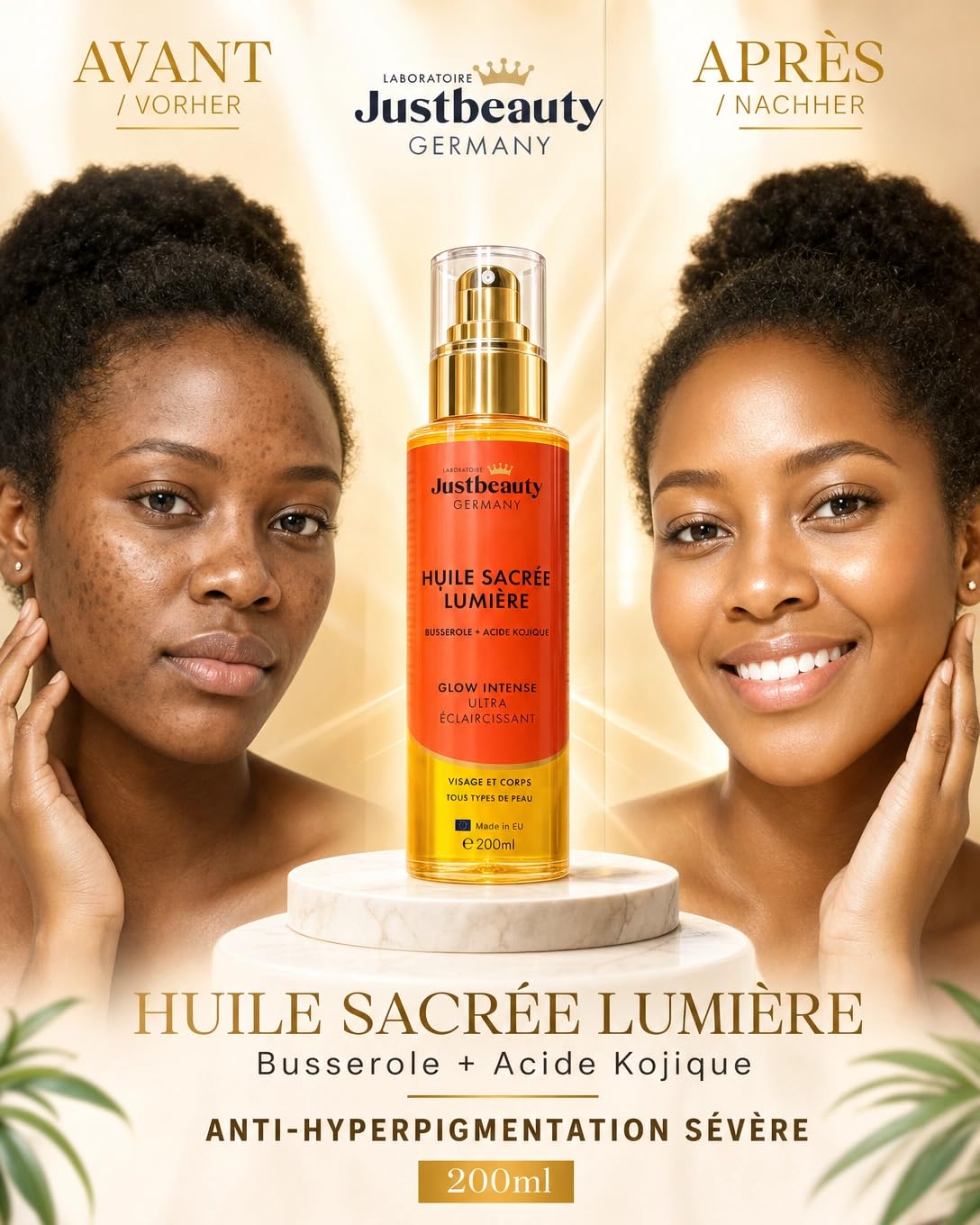 Huile Booster de Busserole - Glow Intense 200ml | Soin Éclaircissant Anti-Taches | Unifie le Teint & Illumine la Peau | Hydratation & Éclat Naturel