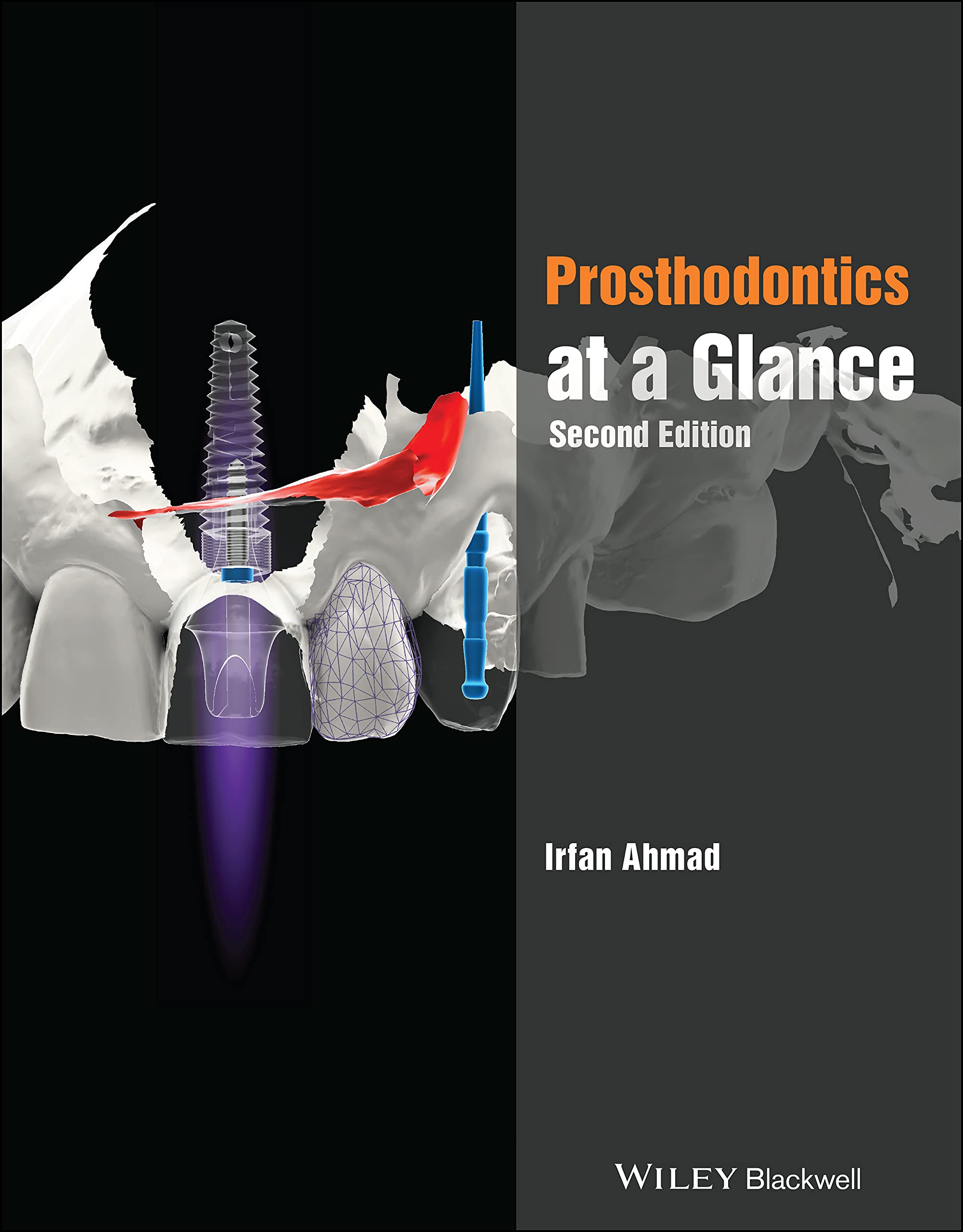 Prosthodontics at a Glance 2nd Edition by Irfan, BDS  Ahmad (Paperback Book)