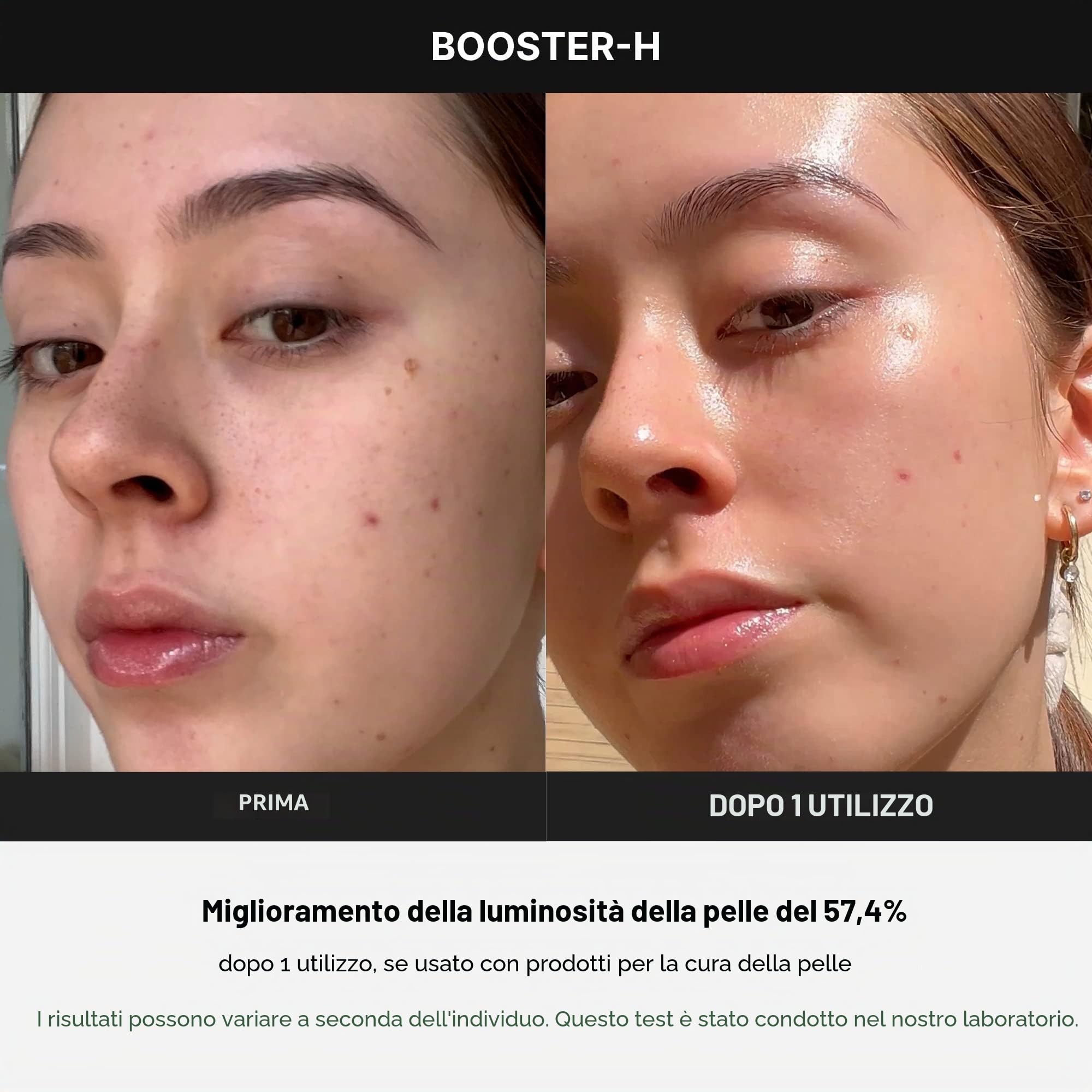 Medicube Age-R Booster H - Dispositivo coreano No.1 per la cura della pelle, booster luminosità facciale senza aghi