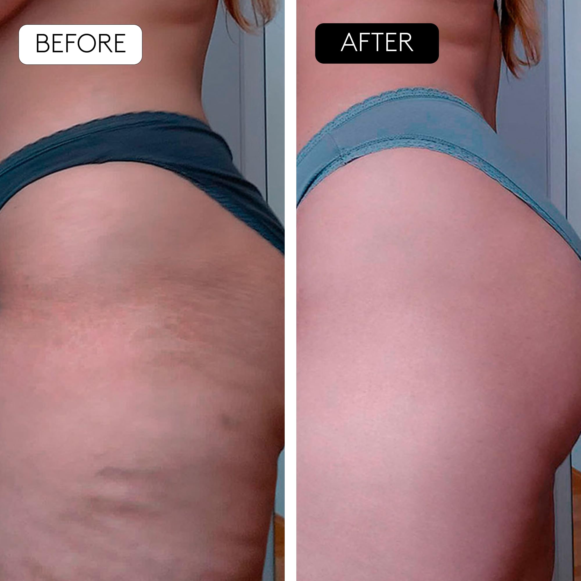 COCUNAT - Body Power - Anti-Cellulite and Slimming - Combats Cellulite - Redefines Silhouette | 150 ml + 125 ml