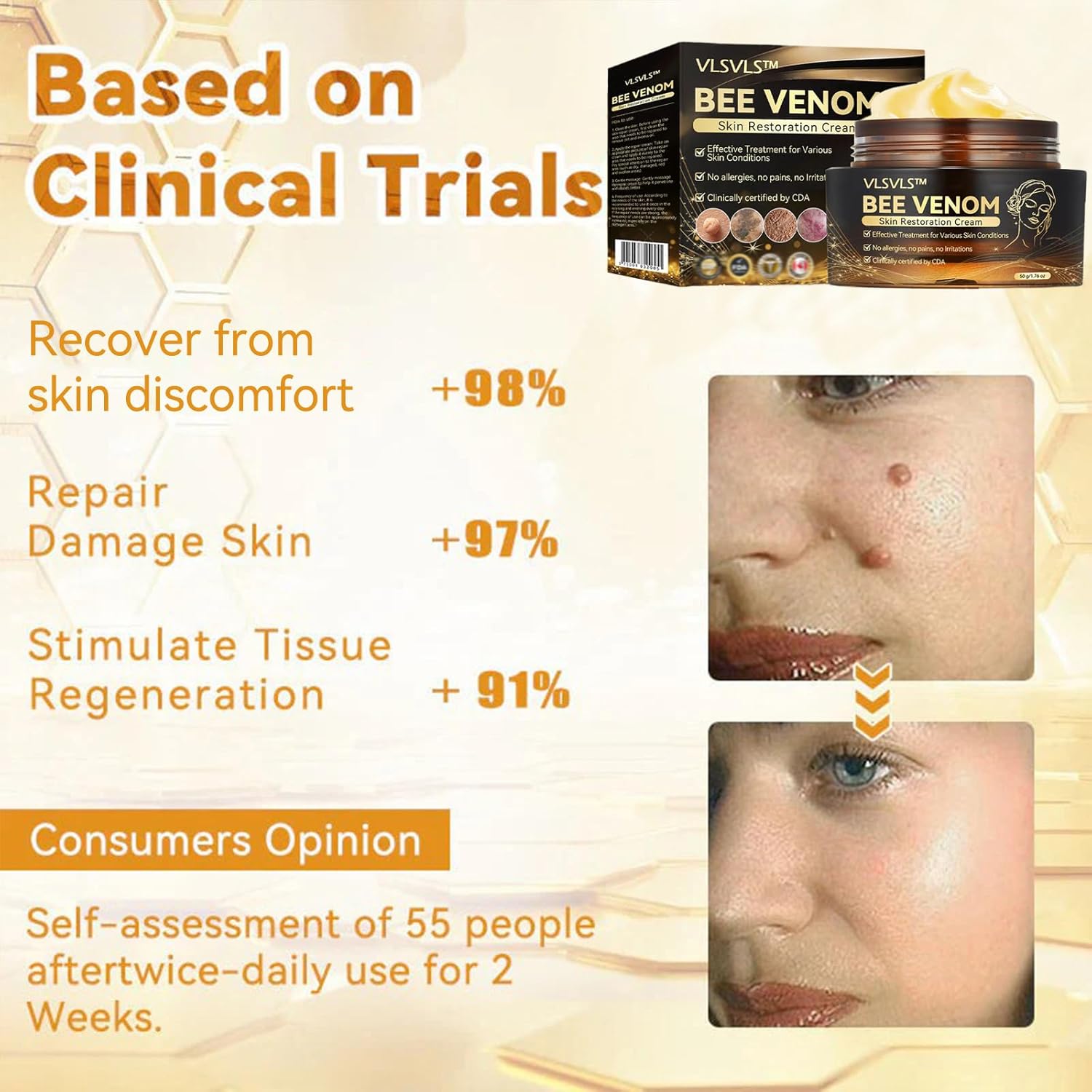 Bee Venom Skin Restoration cream,Bee Venom Skin Treatment Cream,Softens and rejuvenates skin - and reduces imperfections (4PCS)