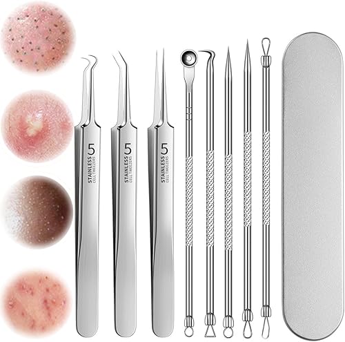 Kit de eliminación de puntos negros de acero inoxidable, kit de herramientas para reventar espinillas, pinzas de espinillas, extractor de