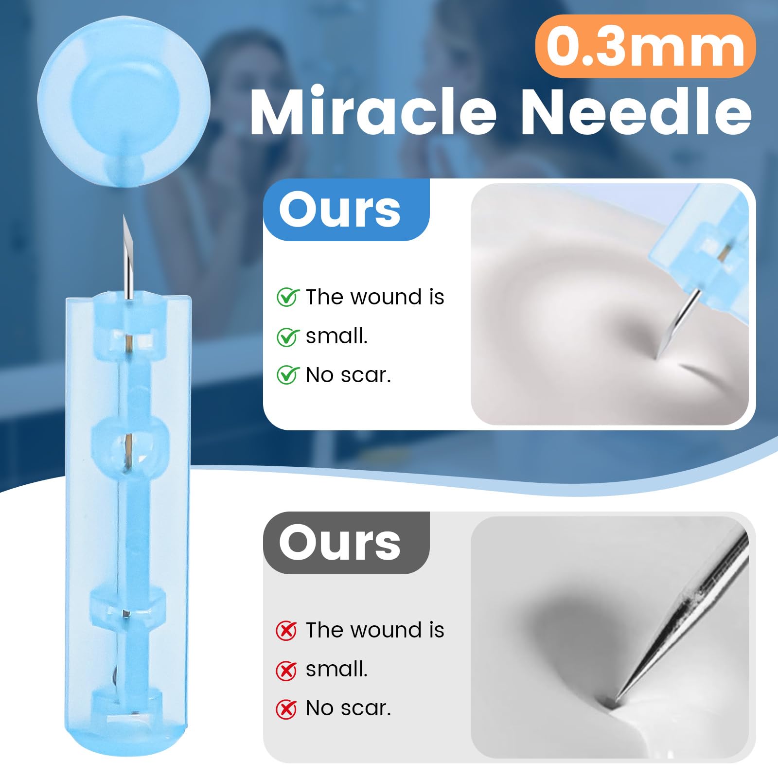 100 Blemish Remover Acné Aguja - Desechables Eliminar Espinillas, Removedor de Puntos Blackhead con 108 Parches Puntuales, Afilado Desechable Blackhead para Limpiador Granos