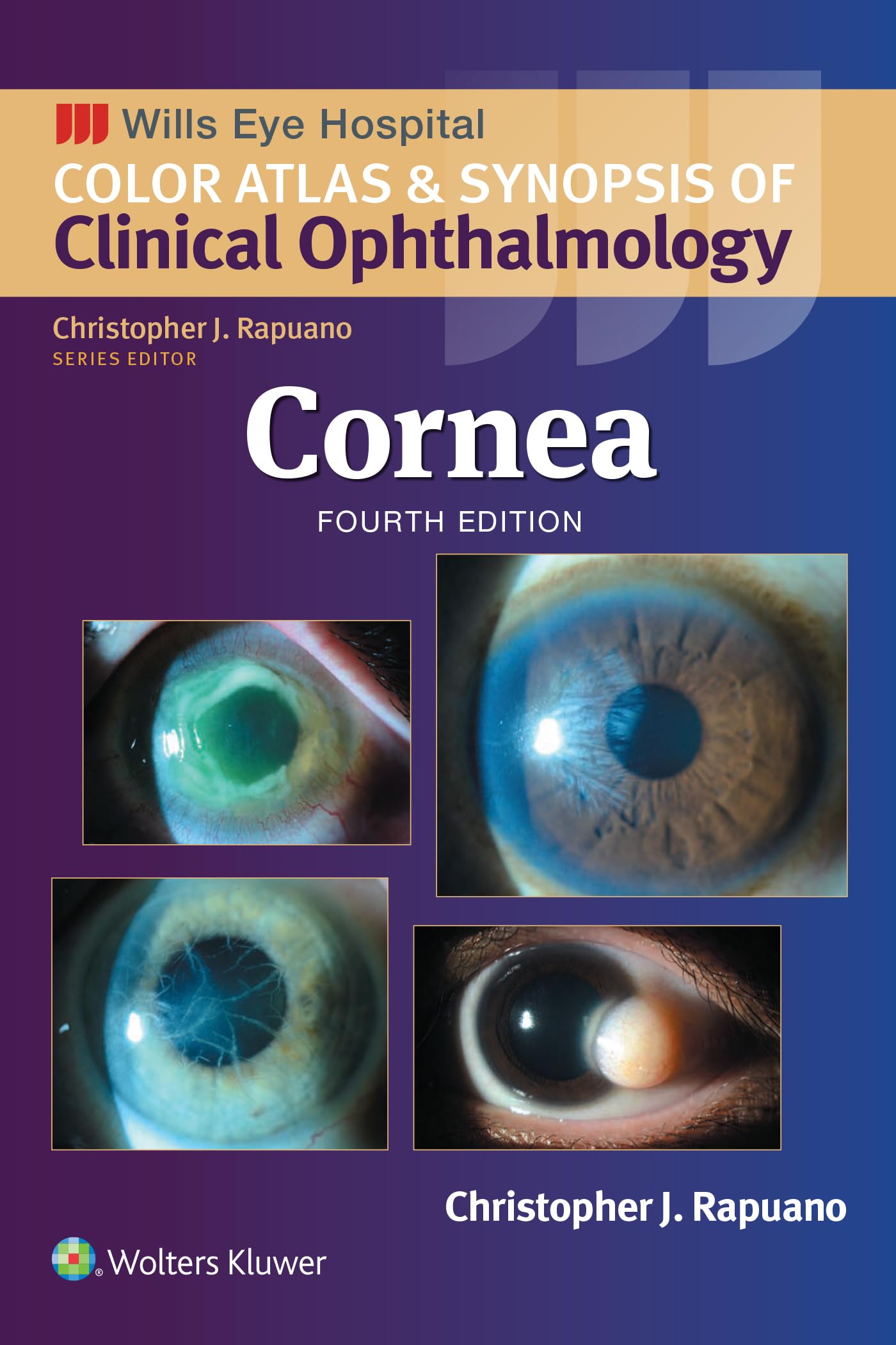 Cornea: eBook without Multimedia (Wills Eye Institute Atlas Series) (English Edition)