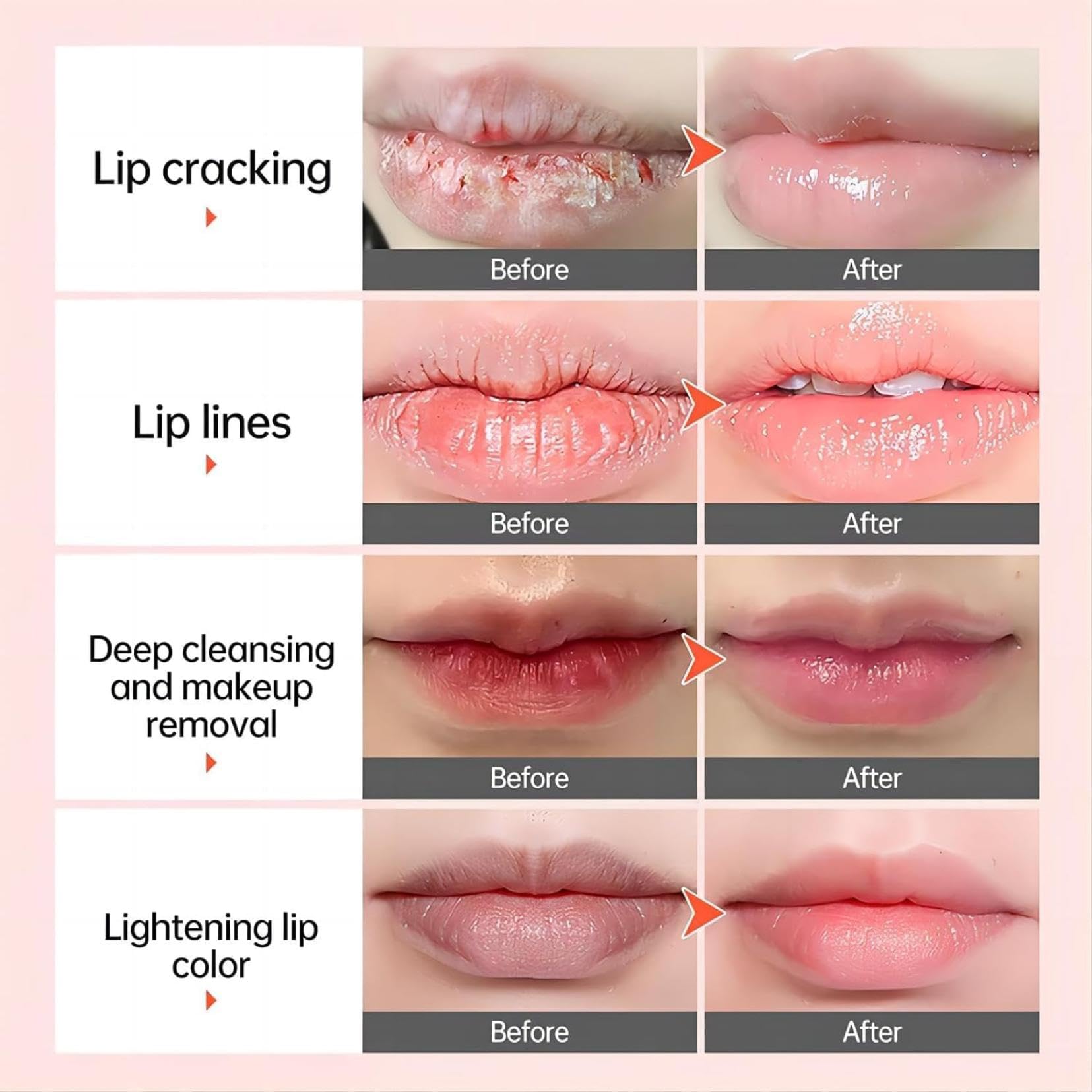 Levre Rose Traitement éclaircissant,Crème Éclaircissante et Baume Hydratant pour les Lèvres Foncées,Baumes à lèvres,Levre Pulpeuse,Prévenir la Sécheresse et Desquamation,pour Homme Femme
