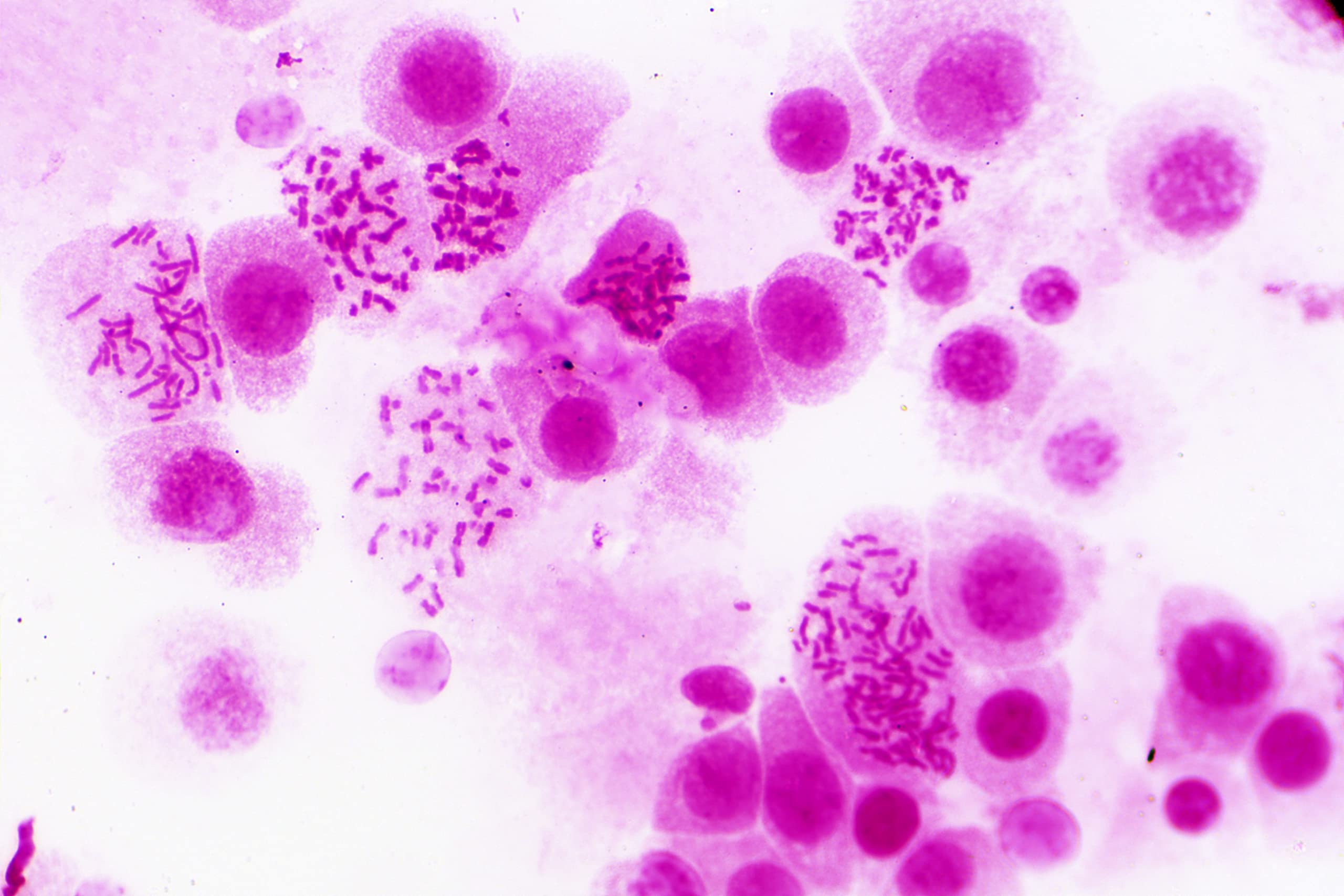 Bresser Muestras Preparadas: Histología