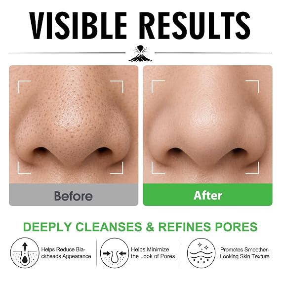 Volcanic Clay Mask Stick for Face, Deep Pore Cleansing & Blackhead Remover Mask with Glycolic Acid, Exfoliating & Oil Control Solid Clay Mask, Pore Minimizer for Smooth Skin, Men & Women