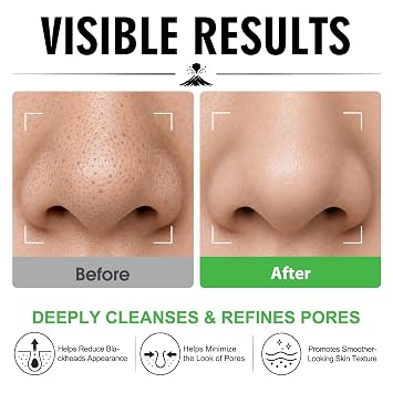 Volcanic Clay Mask Stick for Face, Deep Pore Cleansing & Blackhead Remover Mask with Glycolic Acid, Exfoliating & Oil Control Solid Clay Mask, Pore Minimizer for Smooth Skin, Men & Women
