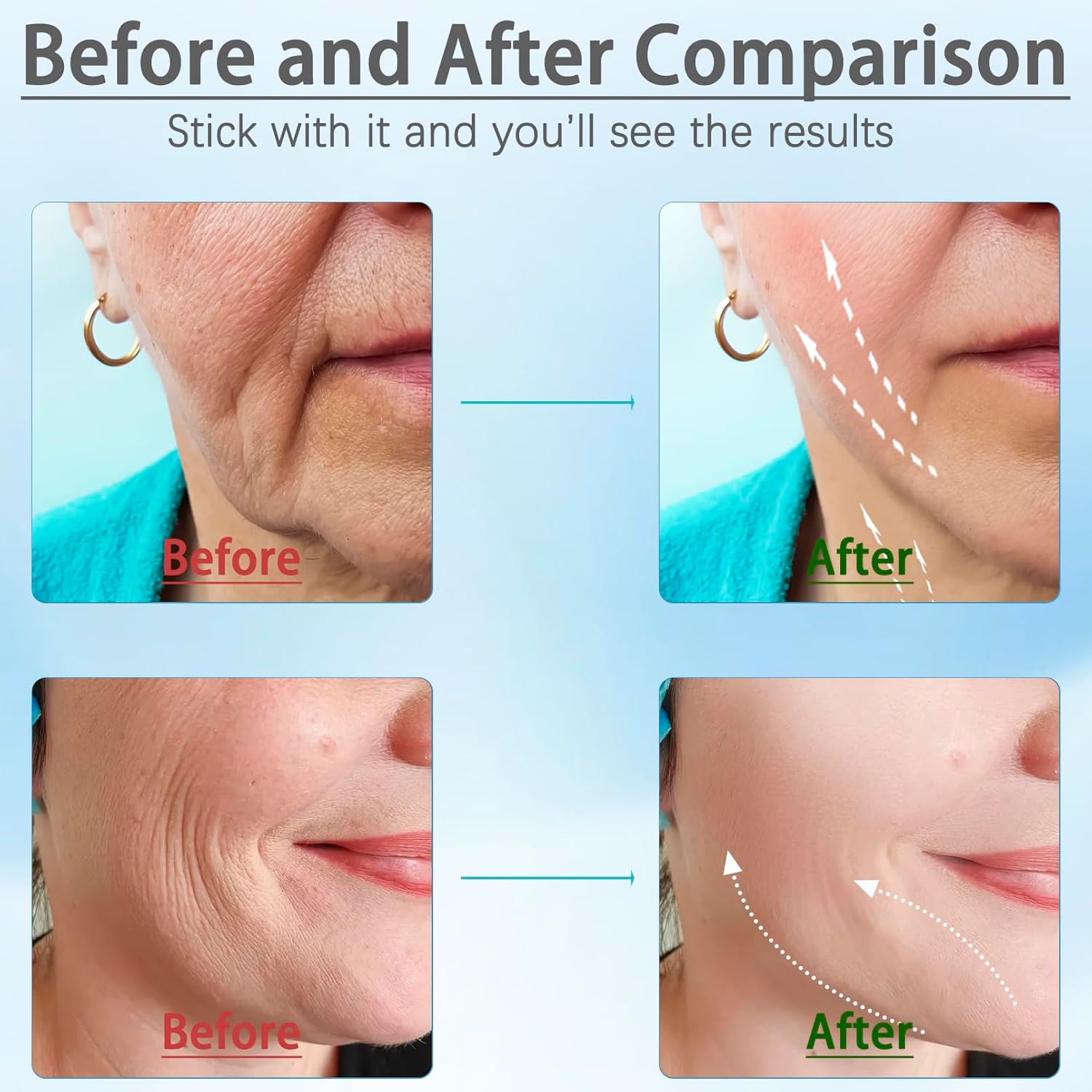 Skin care routine at home for NTZ 7 color care, facial massage with non-slip design, lift device microcramented facial device, with anti-wrinkles. Skin care routine at home for NTZ 7 color care, facial massage with non-slip design, lift device microcramented facial device, with anti-wrinkles.
