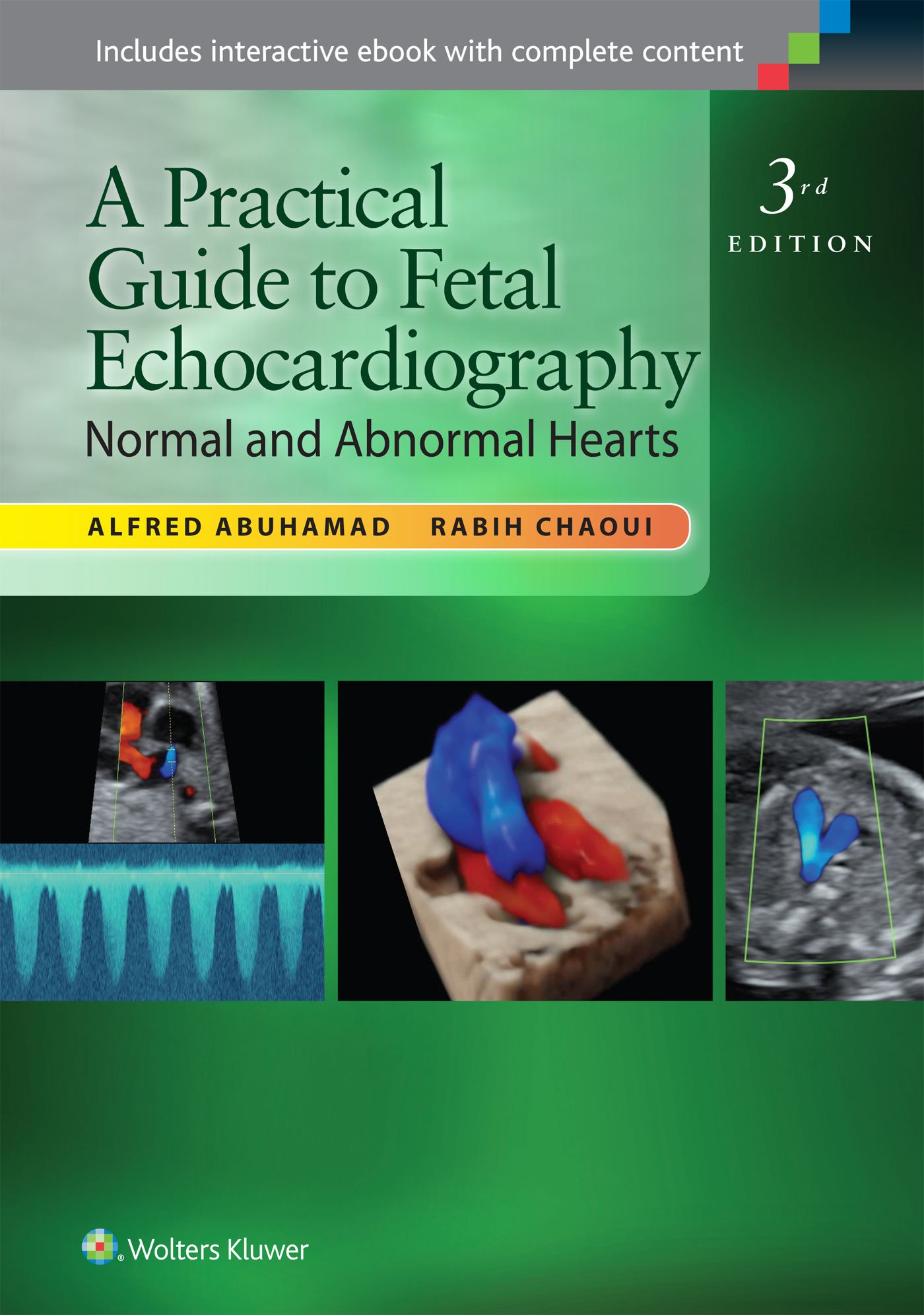A Practical Guide to Fetal Echocardiography: Normal and Abnormal Hearts Third Edition