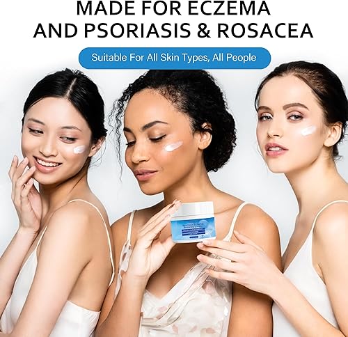 Miniatura 5 de Everlom Crema para la psoriasis potente tratamiento del cuero cabelludo para la dermatitis seborreica, foliculitis, cuero cabelludo seco y caspa -