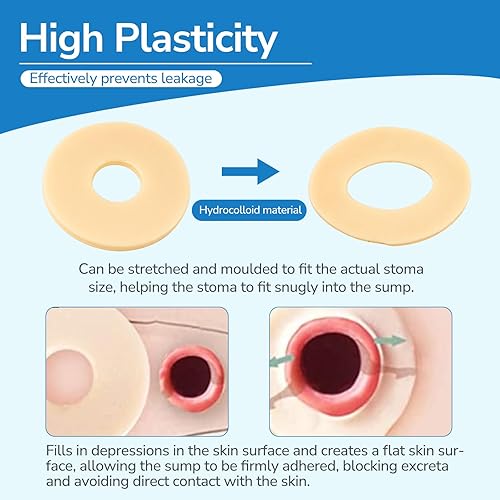 Miniatura 3 de 30 anillos de barrera para ostomía, anillos moldeables de ostomía de 0.157 in de grosor, anillos de barrera adhesiva hidrocoloide de grado médico,