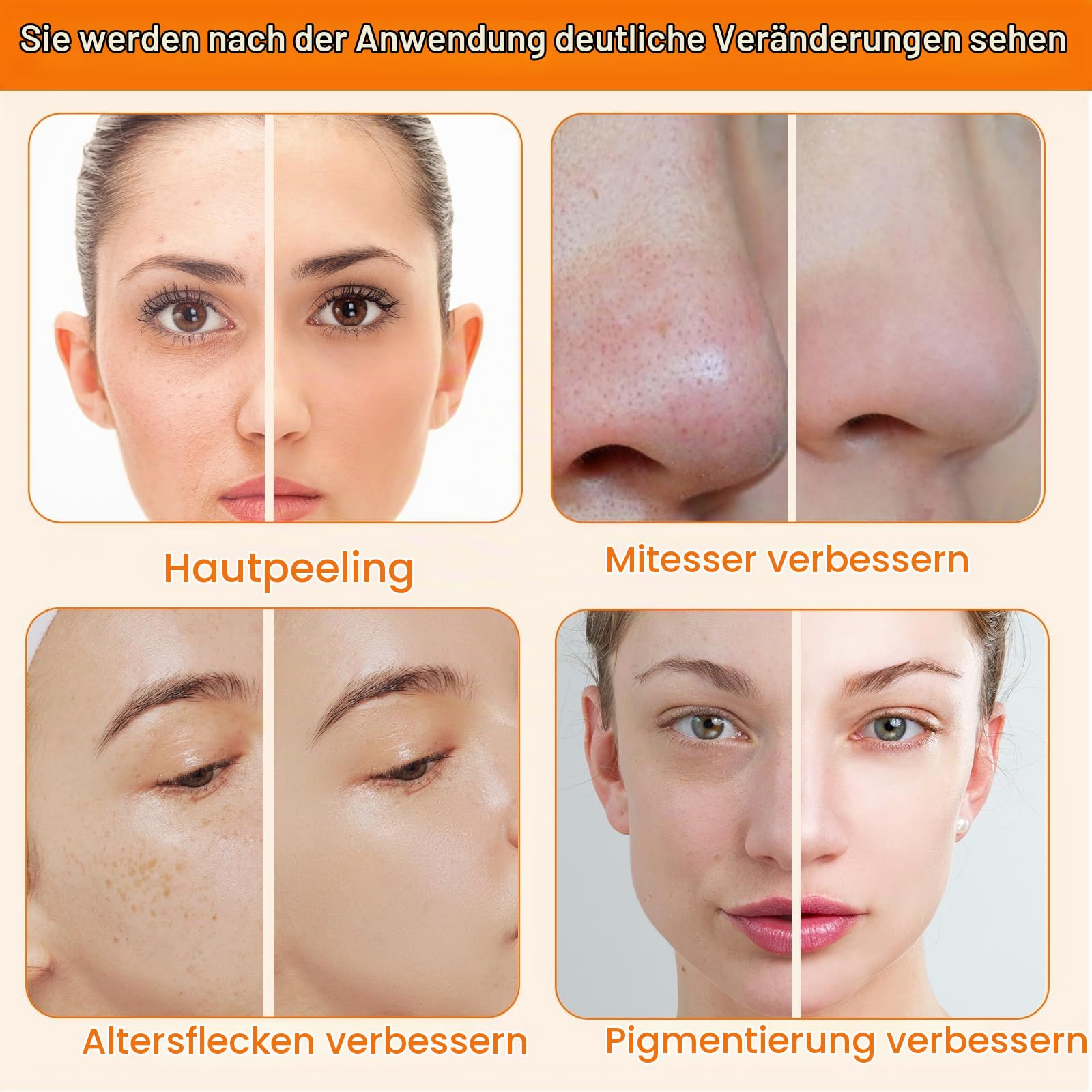 3 in 1 Diamant Mikrodermabrasionsgerät | Dermabrasionsgerät für Peeling und Mitesserentfernung, Gesichtspflegegerät für den Heim Spa Einsatz