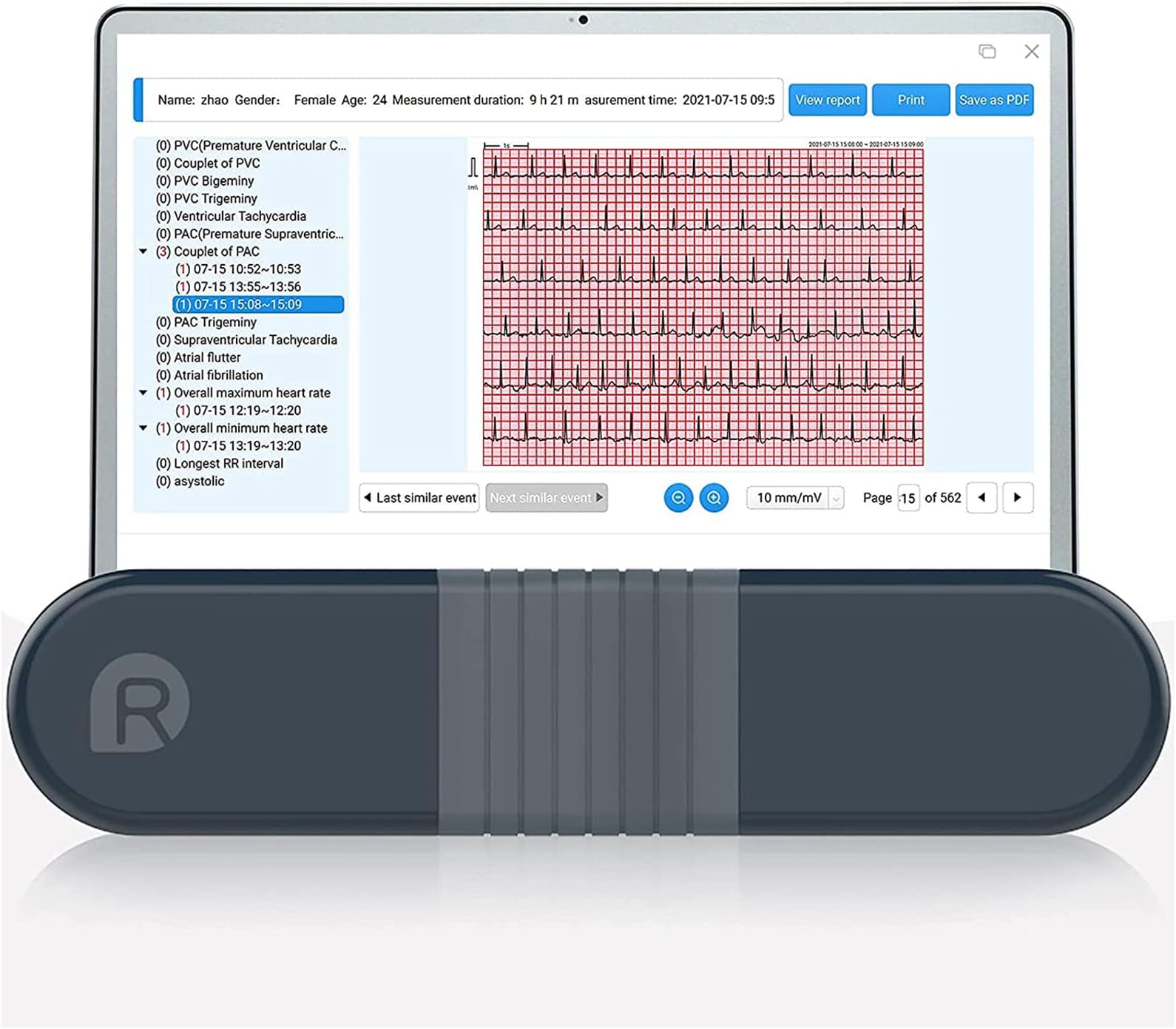 Wellue ECG Monitor, Professional Holter Recorder with AI-ECG Analysis Report, 24-hours ECG Holter Record, Support PC Software, ECG Waveform PDF Printing, Portable Heart Health Tracker for Home Use