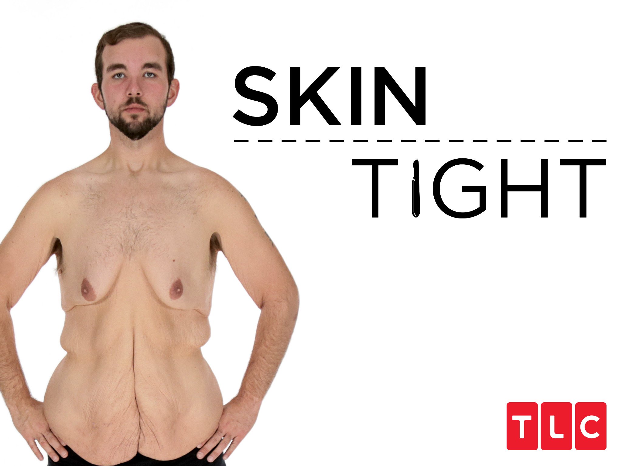 My 600-lb Life: Skin Tight Season 3